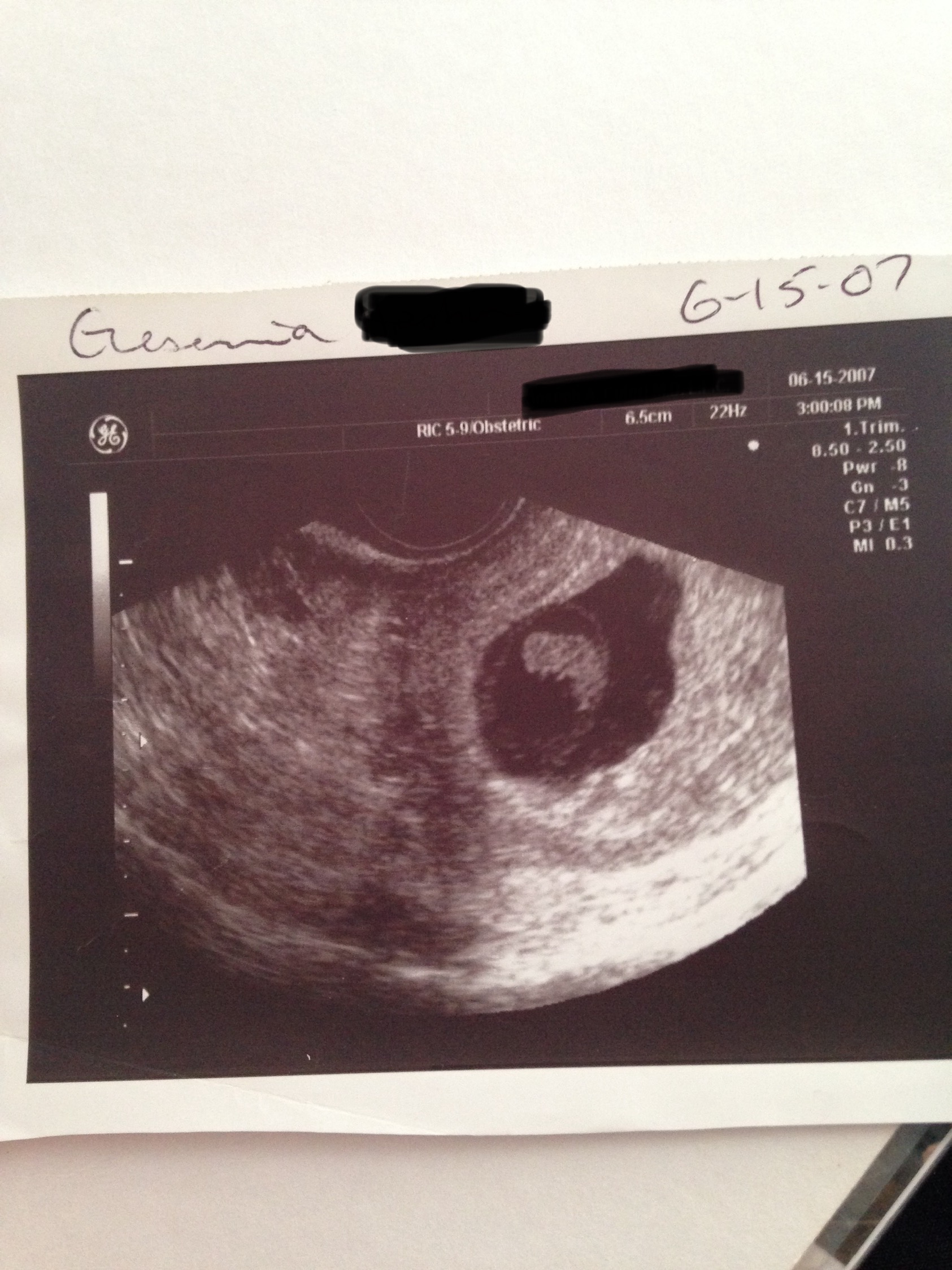 Help Us Start Our Family Through IVF campaign photo, 6 of 7