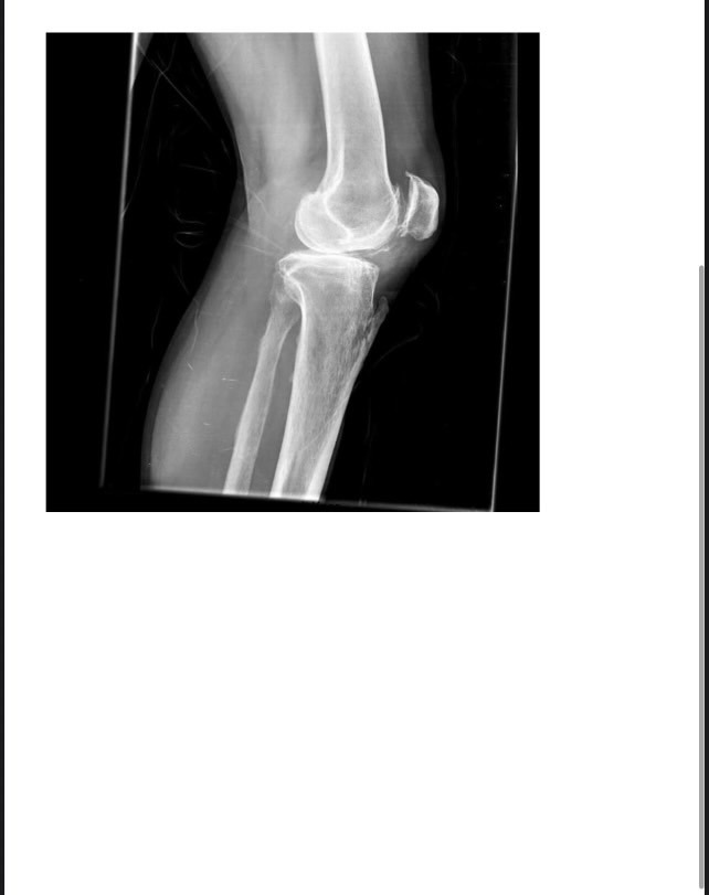Help Gino Walk & Wrestle Again – Knee Surgery Fund campaign photo, 6 of 8
