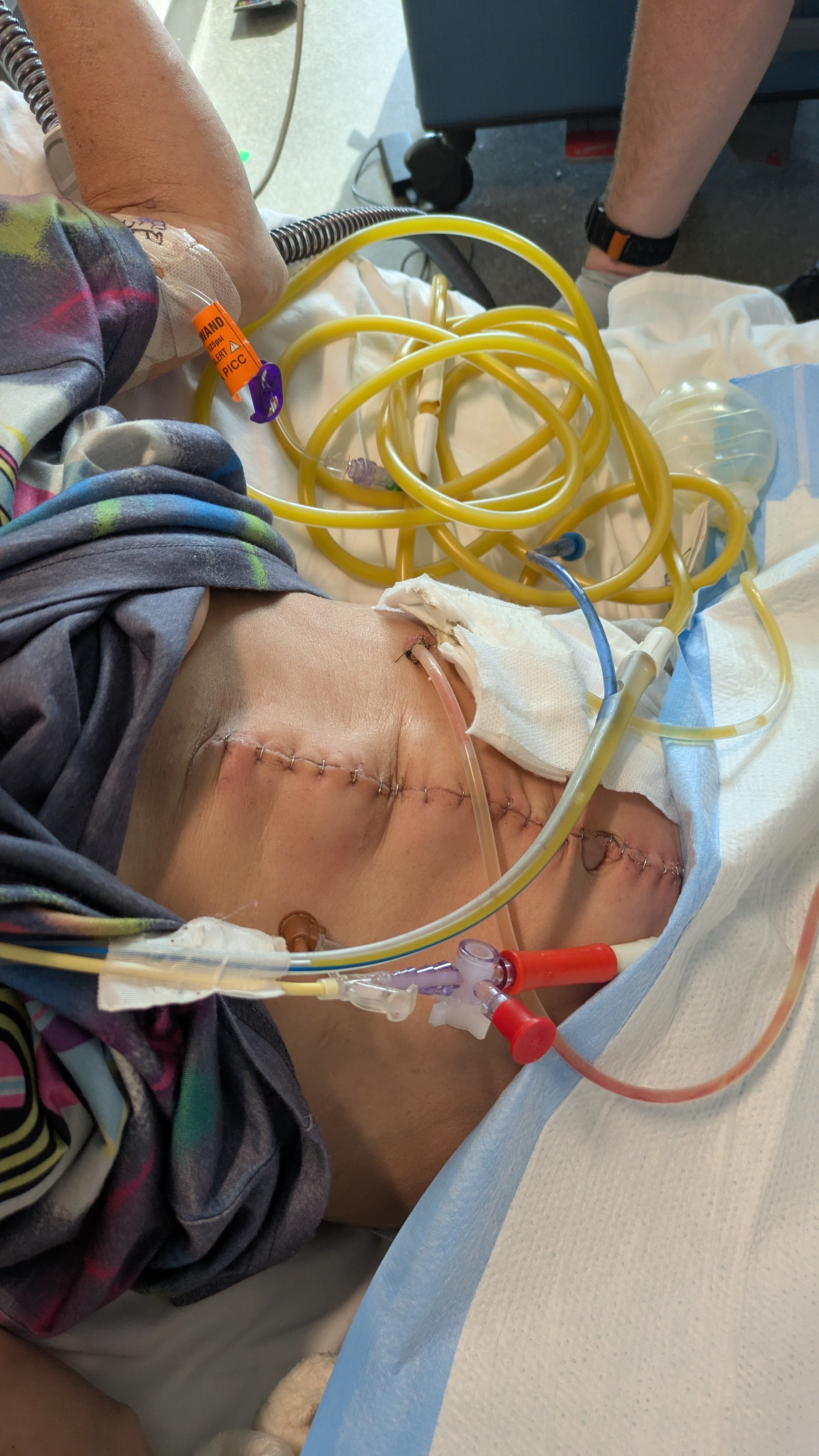 A Son's Devastating Car Accident Saved His Mother's Life campaign photo, 4 of 8