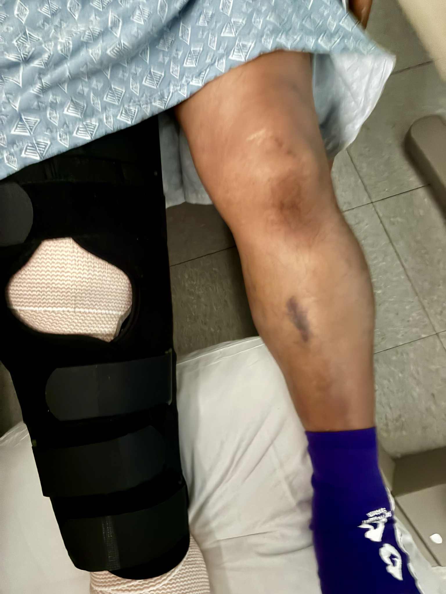 Sergio Hernandez medical needs due to fatal accident campaign photo, 4 of 5