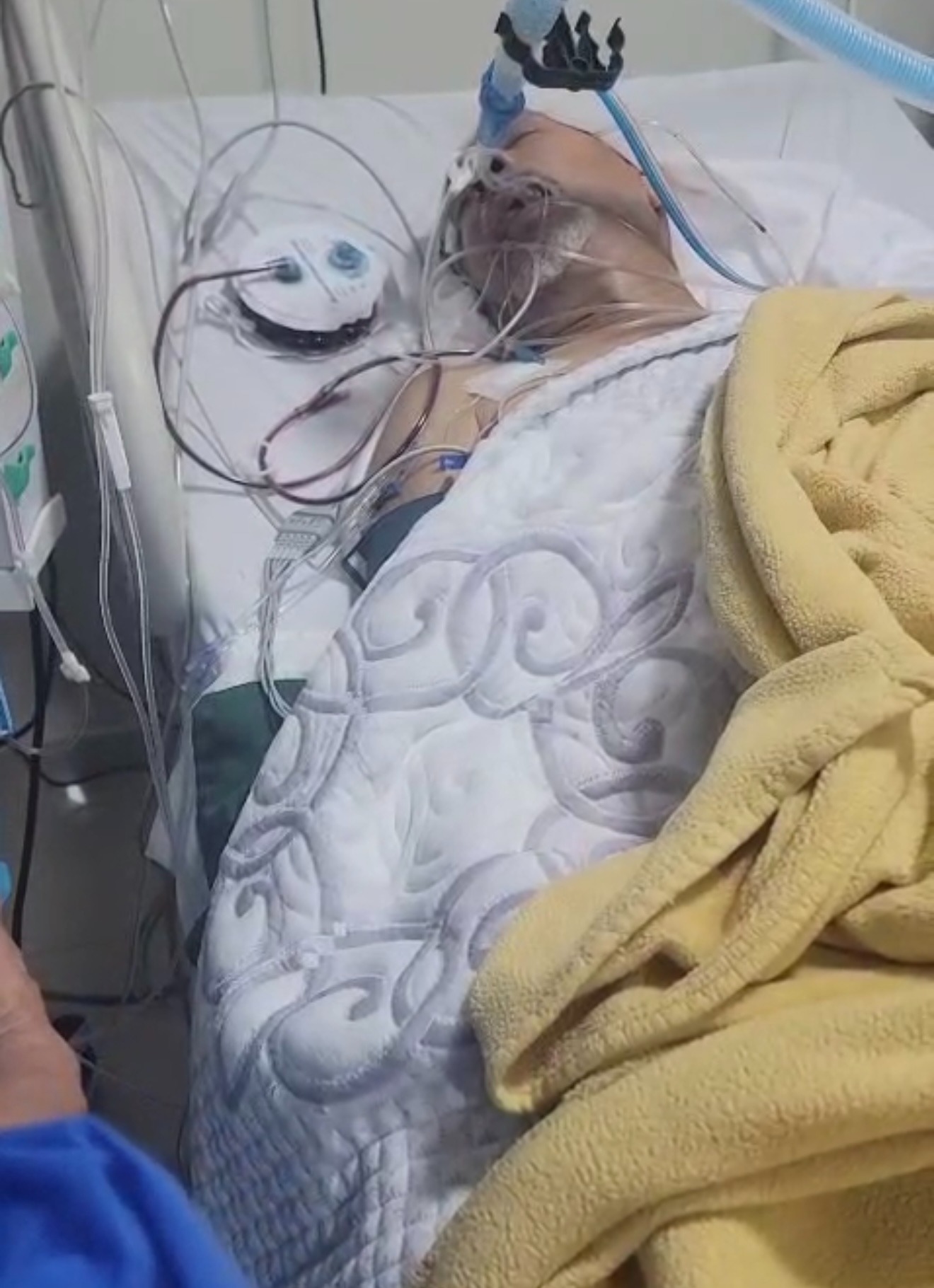 Help Save My Uncle Hector - Emergency Brain Surgery in DR campaign photo, 2 of 4