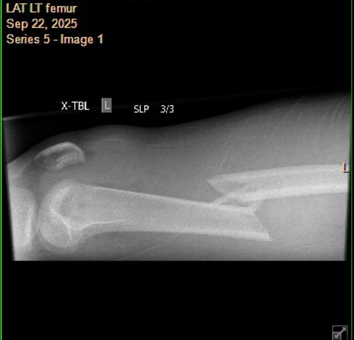 Help Syam Heal & Recover campaign photo, 7 of 8