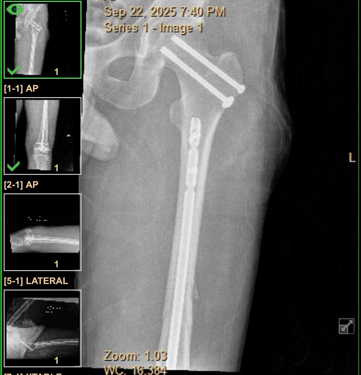 Help Syam Heal & Recover campaign photo, 2 of 8