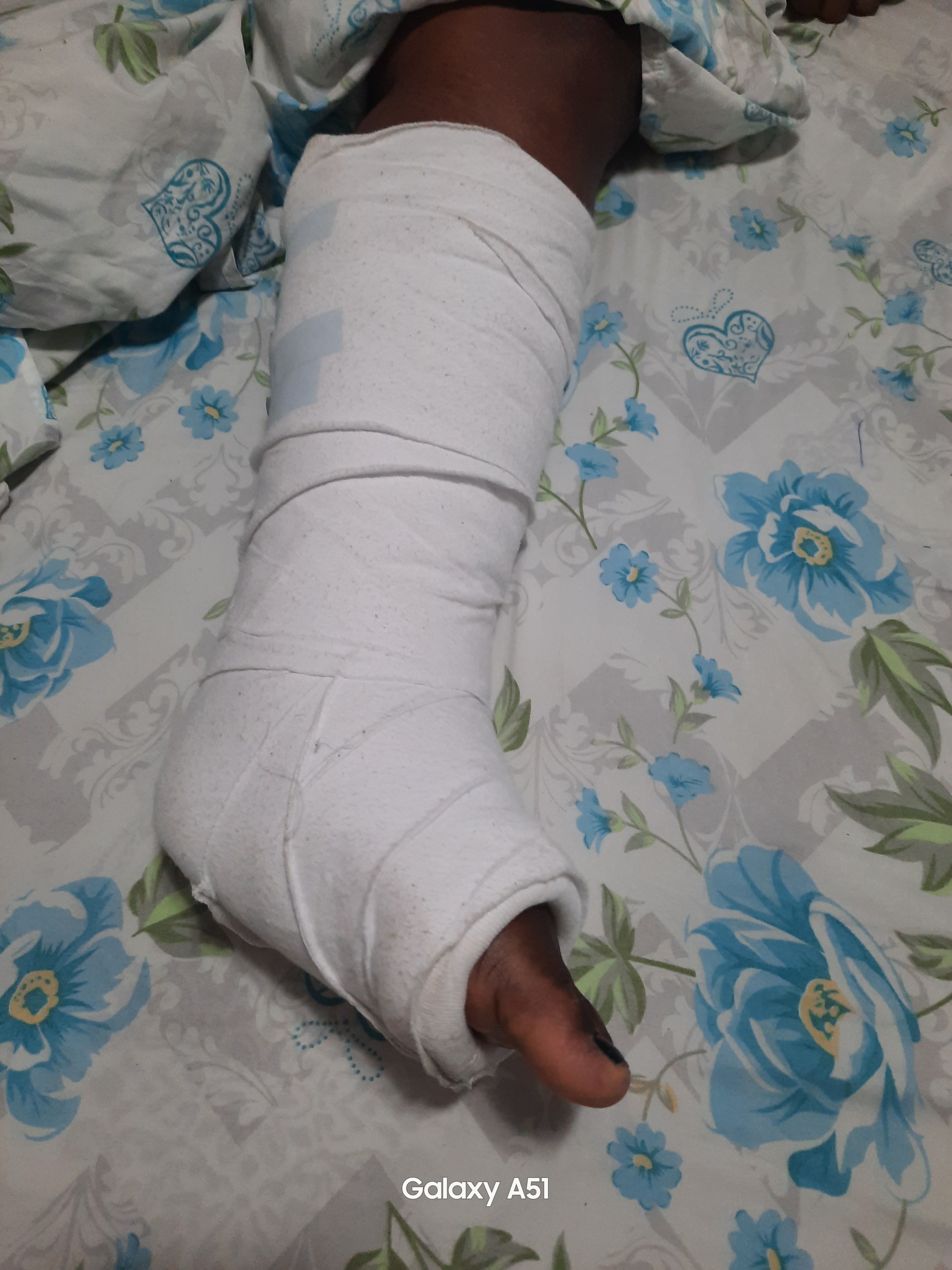 Seeking help to go under a minor surgery. campaign photo, 6 of 7