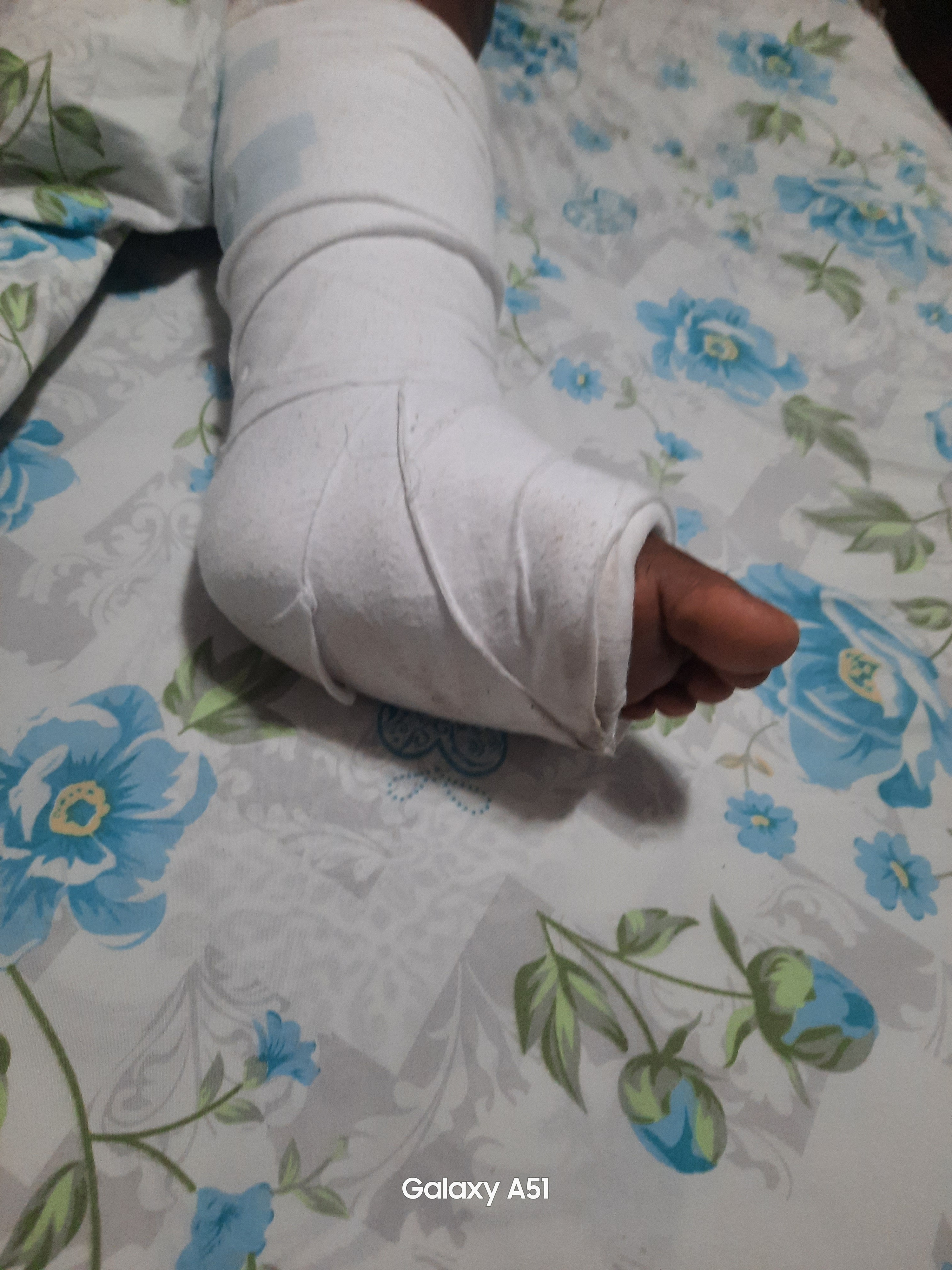 Seeking help to go under a minor surgery. campaign photo, 4 of 7
