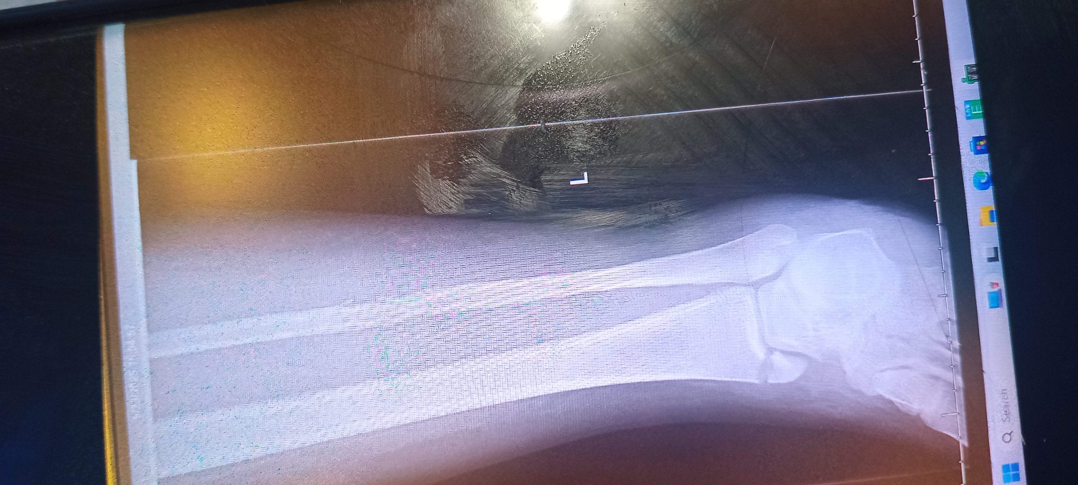 Seeking help to go under a minor surgery. campaign photo, 5 of 7
