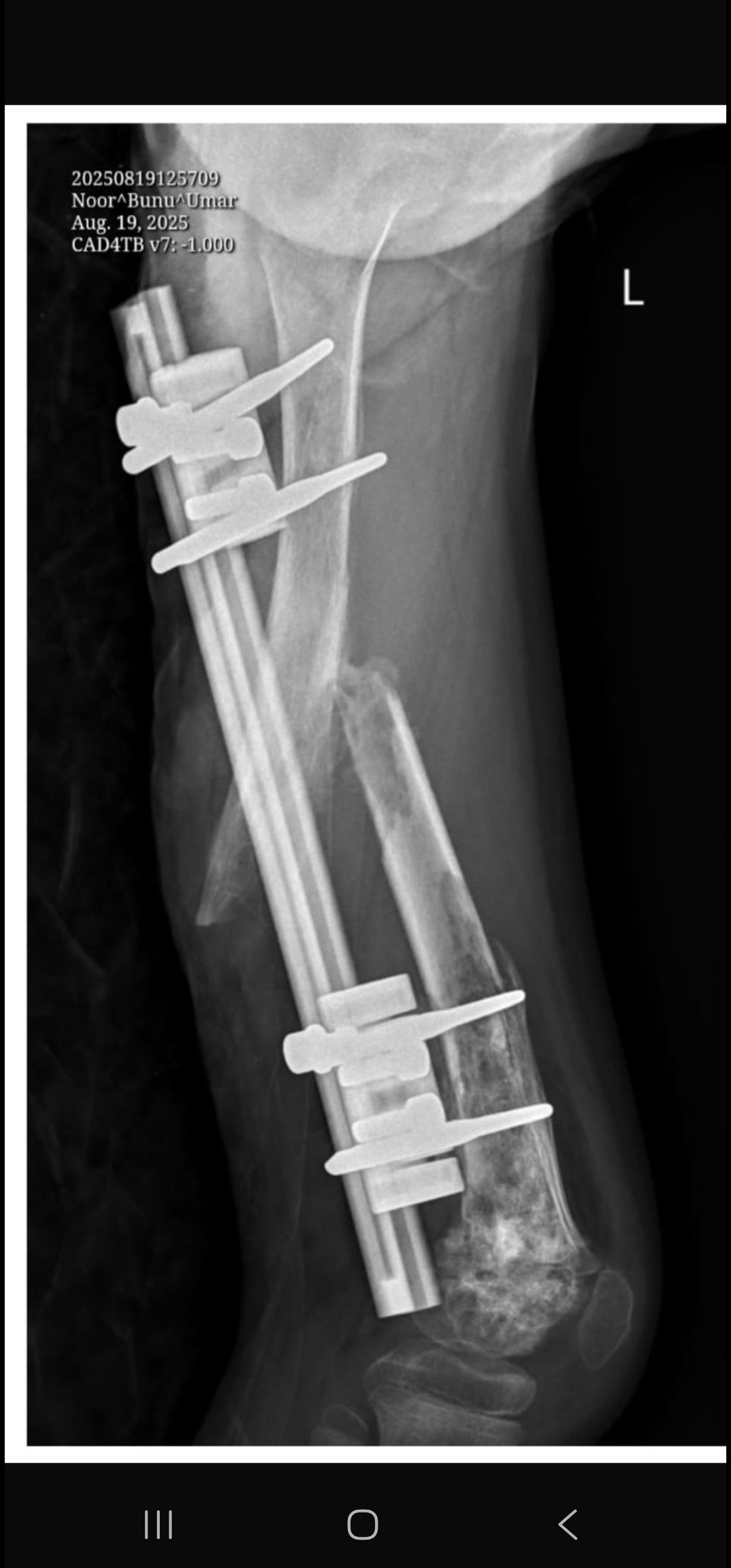 Donate to help a 7 year old girl with medical bills. campaign photo, 4 of 7