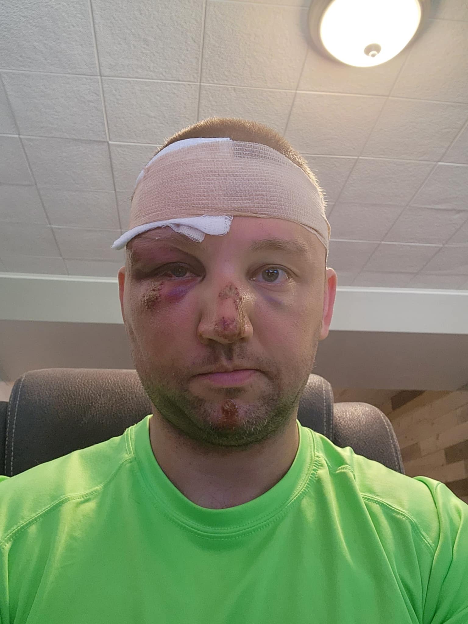 Help me survive medical debt from my July 11th 2024 accident campaign photo, 2 of 6