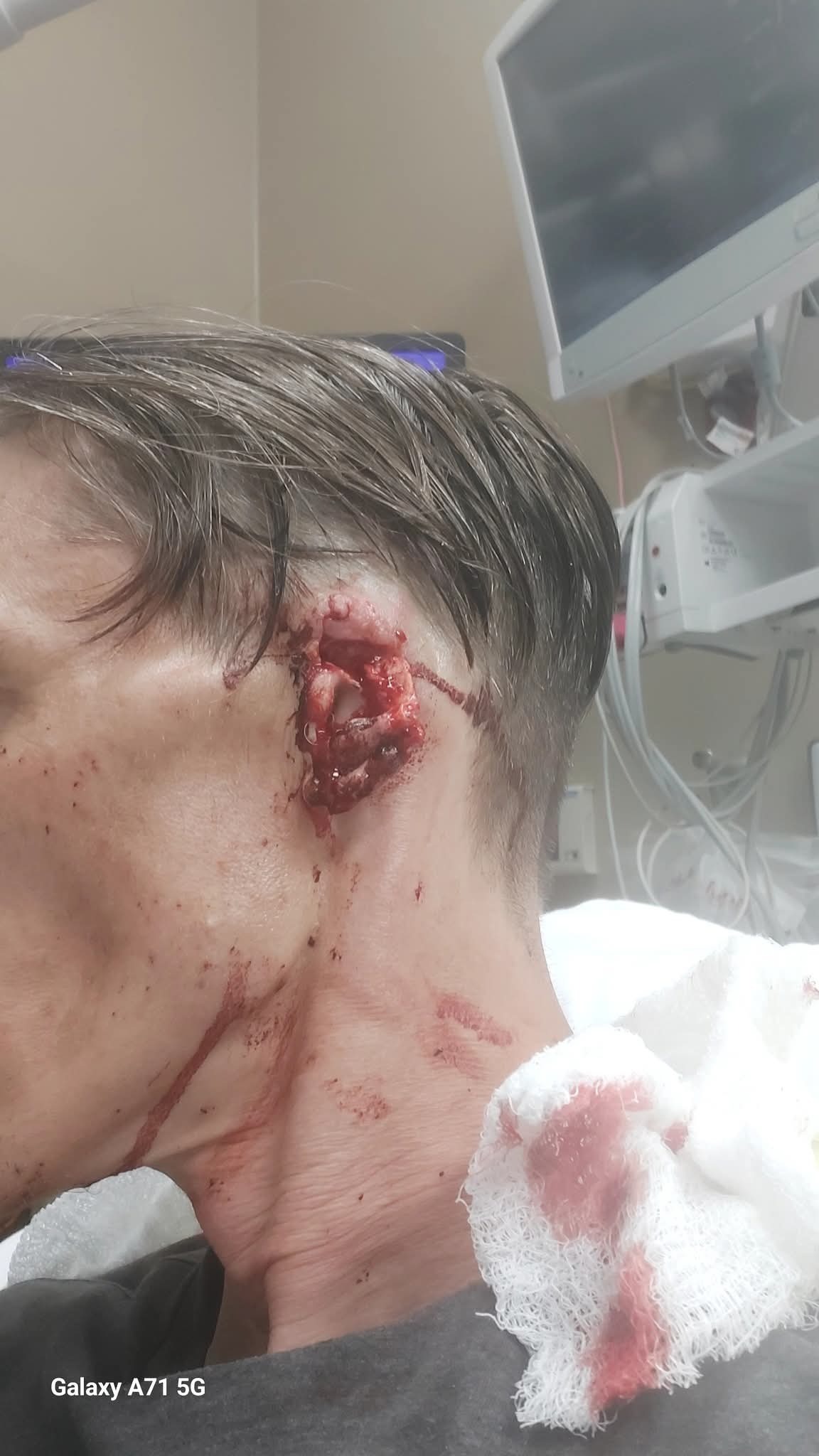 Support Travis's Surgery and Healing Journey campaign photo, 6 of 7