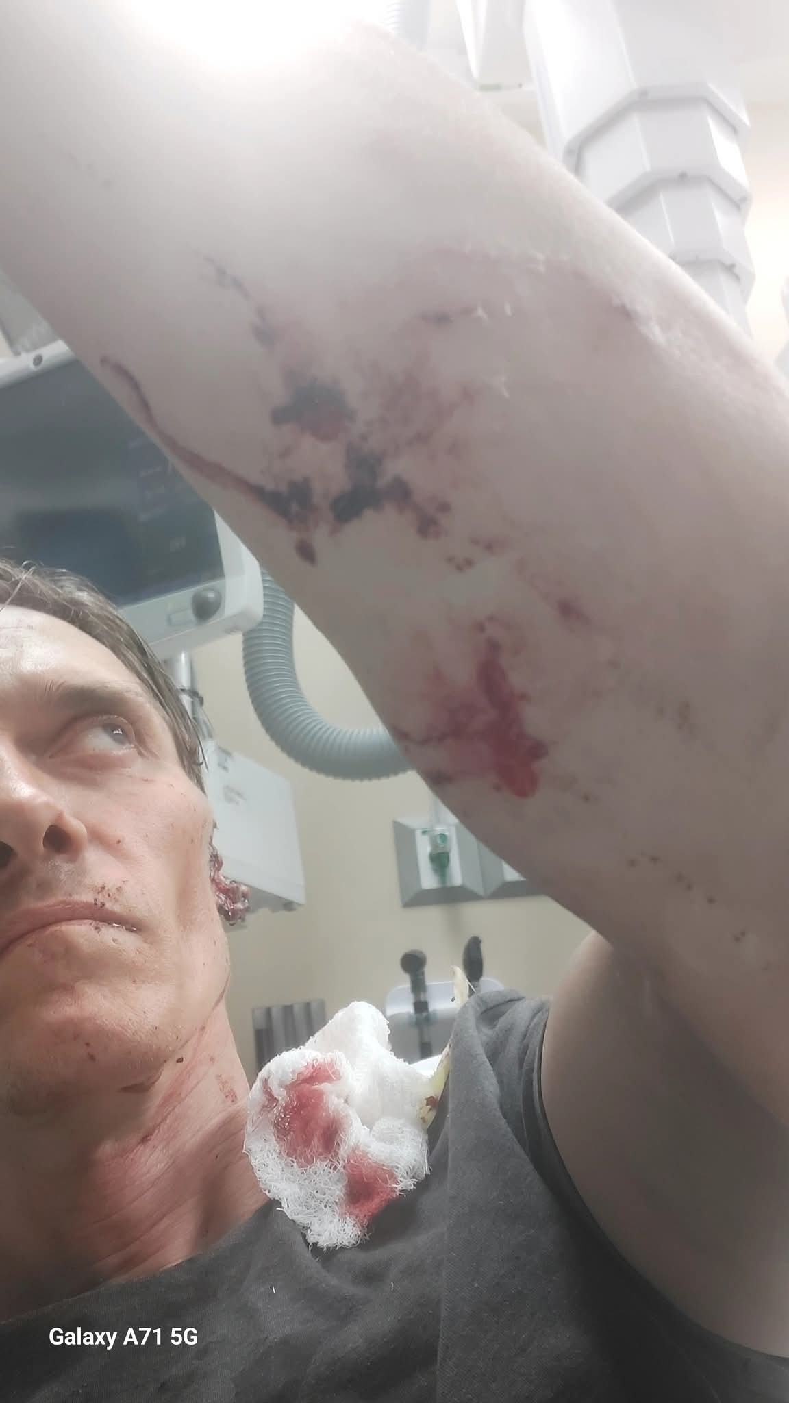 Support Travis's Surgery and Healing Journey campaign photo, 2 of 7