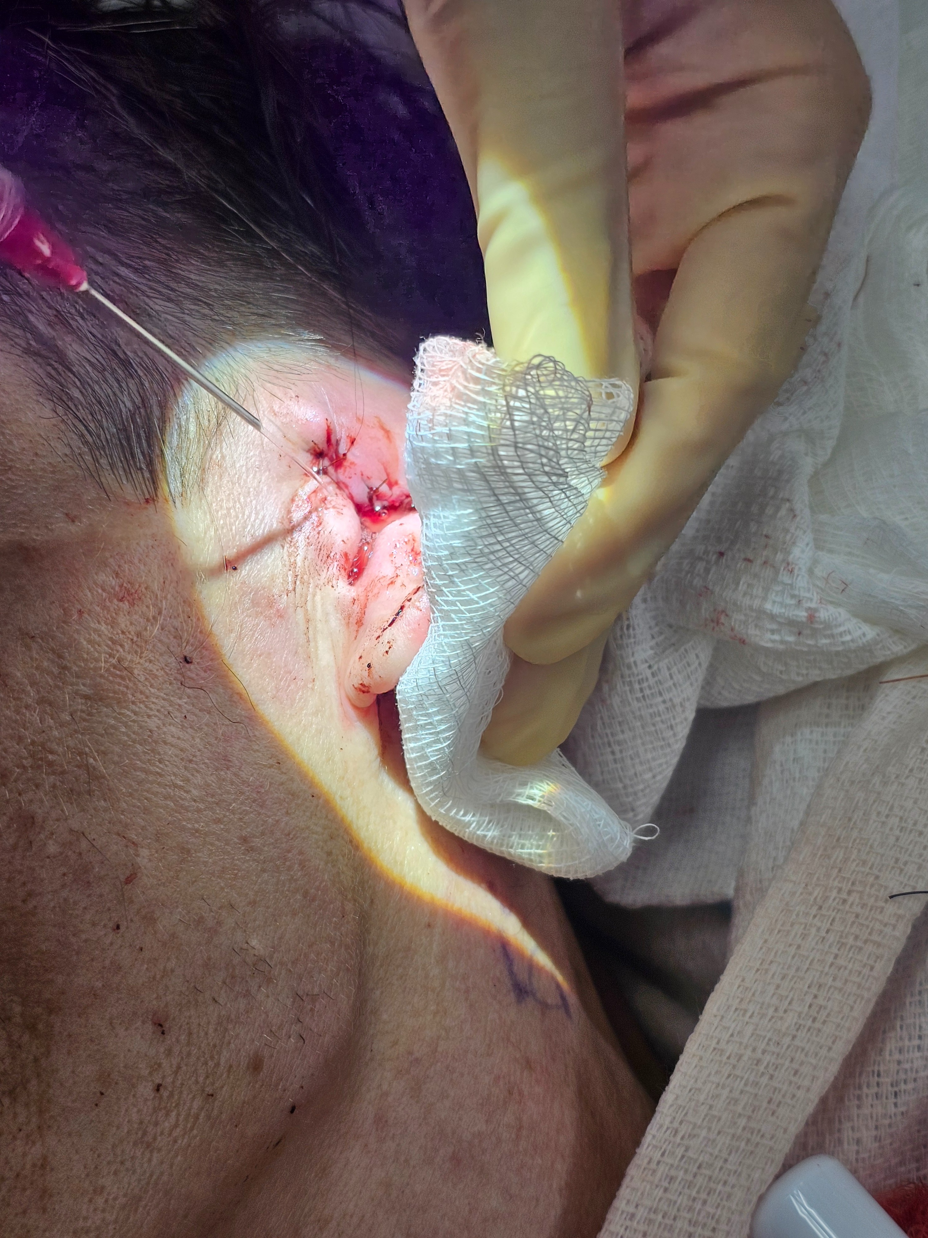 Support Travis's Surgery and Healing Journey campaign photo, 4 of 7