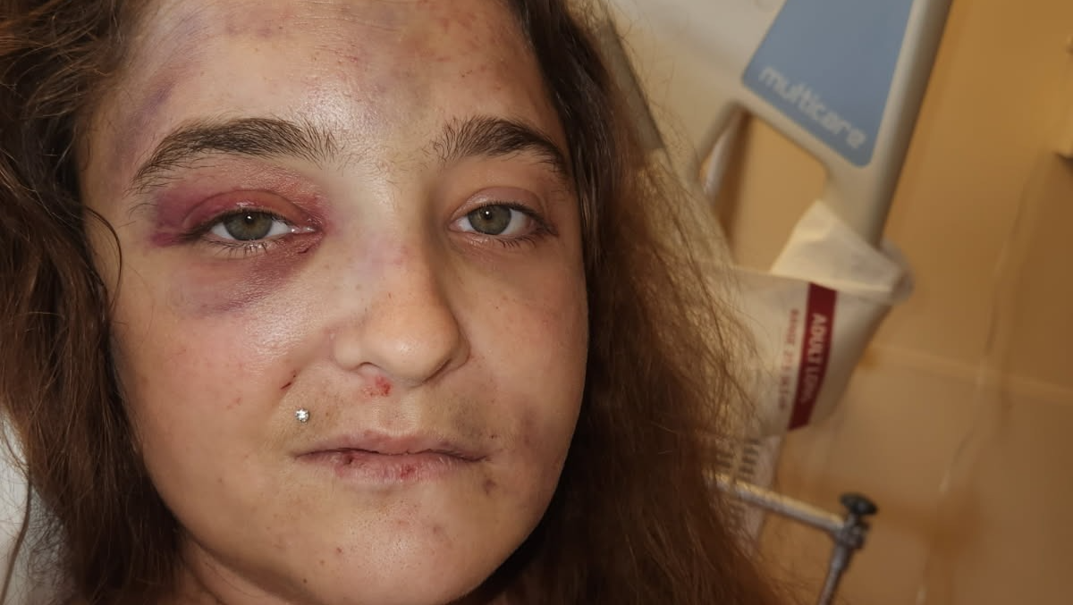 Help Support My Sister After a Horrific Car Accident photo