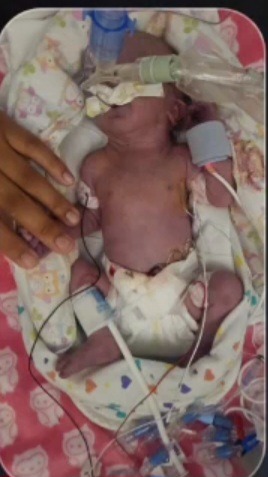 Honoring Our Baby Imogen Adalaide Pena-Perry campaign photo, 2 of 6