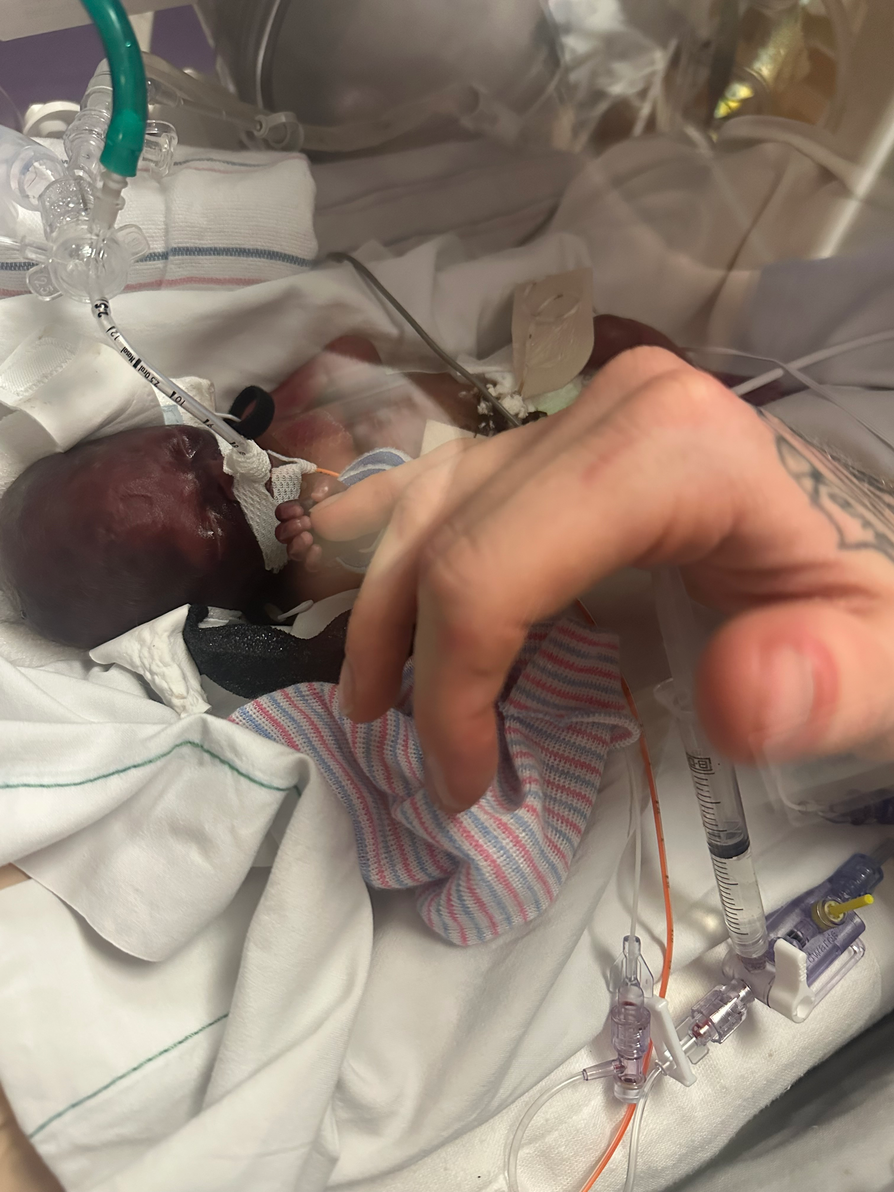 Cremation needed-of twin daughters Lakelynn & Robyn campaign photo, 5 of 8