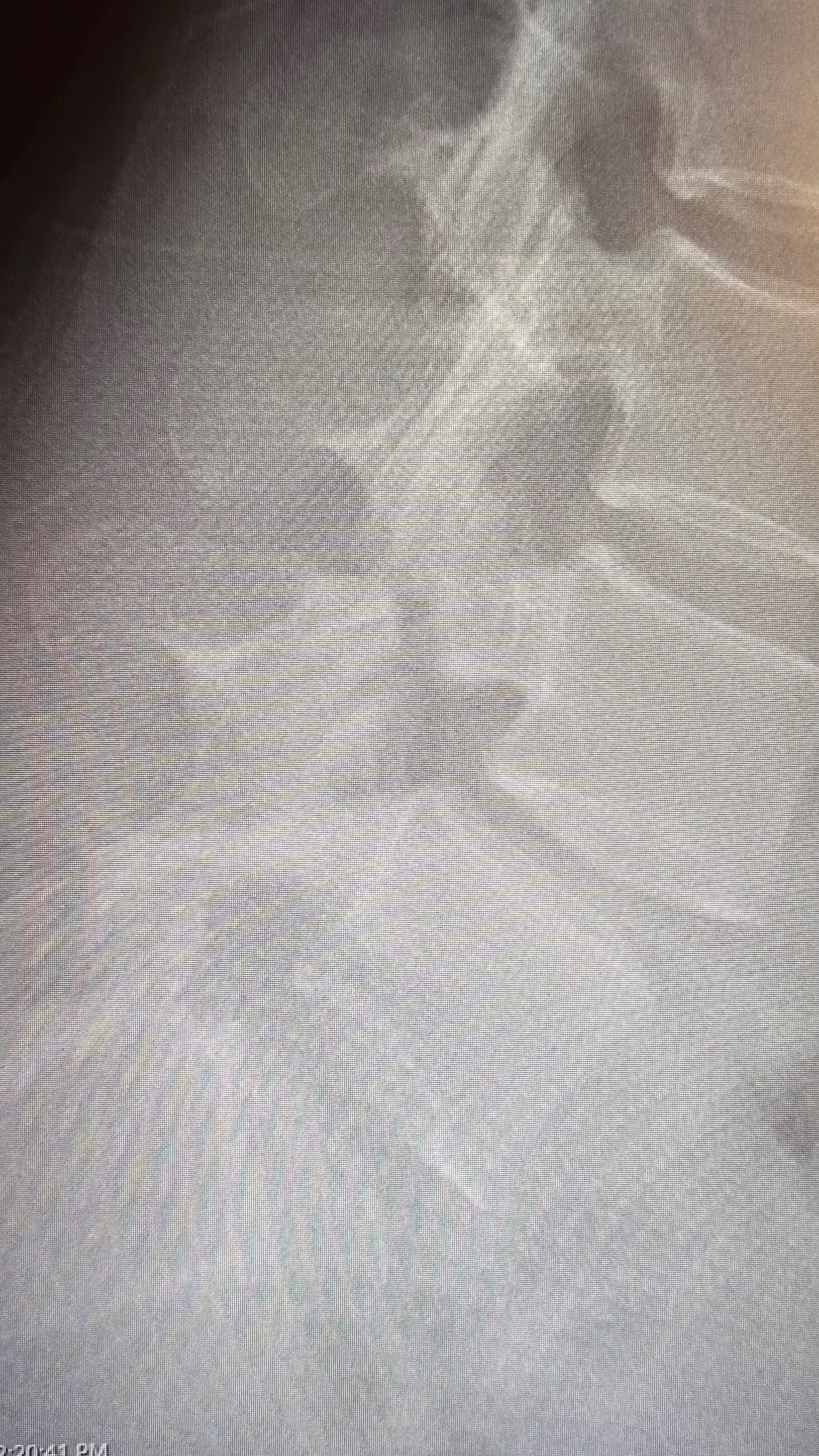 Hilary Anderson needs back surgery campaign photo, 4 of 6