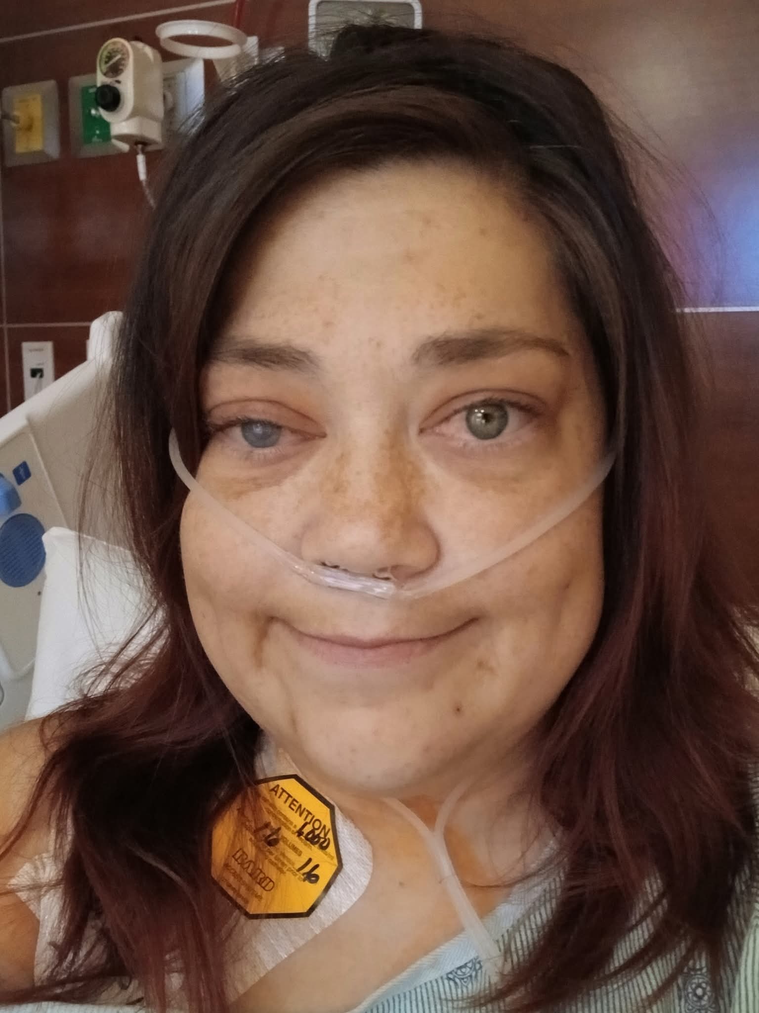 Azarias fight against her dieing kidneys campaign photo, 2 of 7