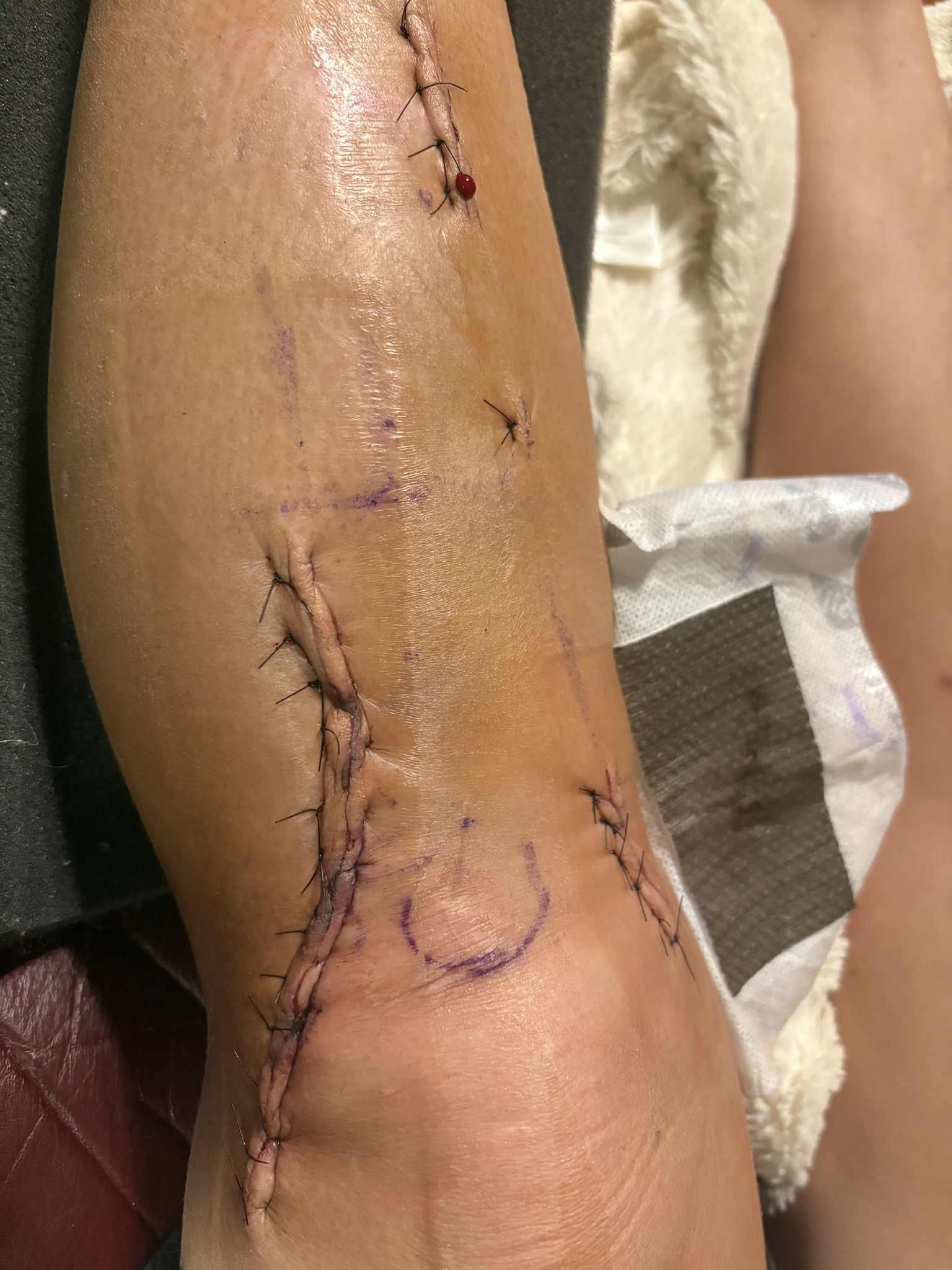 Help Jessie Schuerman Recover from Injury campaign photo, 4 of 8