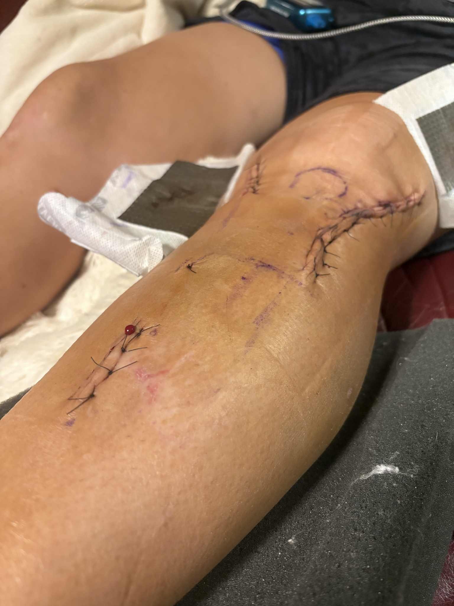 Help Jessie Schuerman Recover from Injury campaign photo, 5 of 8