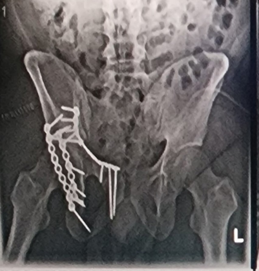 Help John on His Road to Recovery After a Tragic Accident campaign photo, 2 of 6