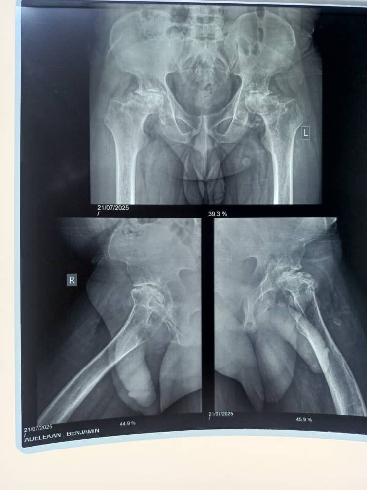 Help Benjamin Walk Again: A Father's Plea for help campaign photo, 7 of 8