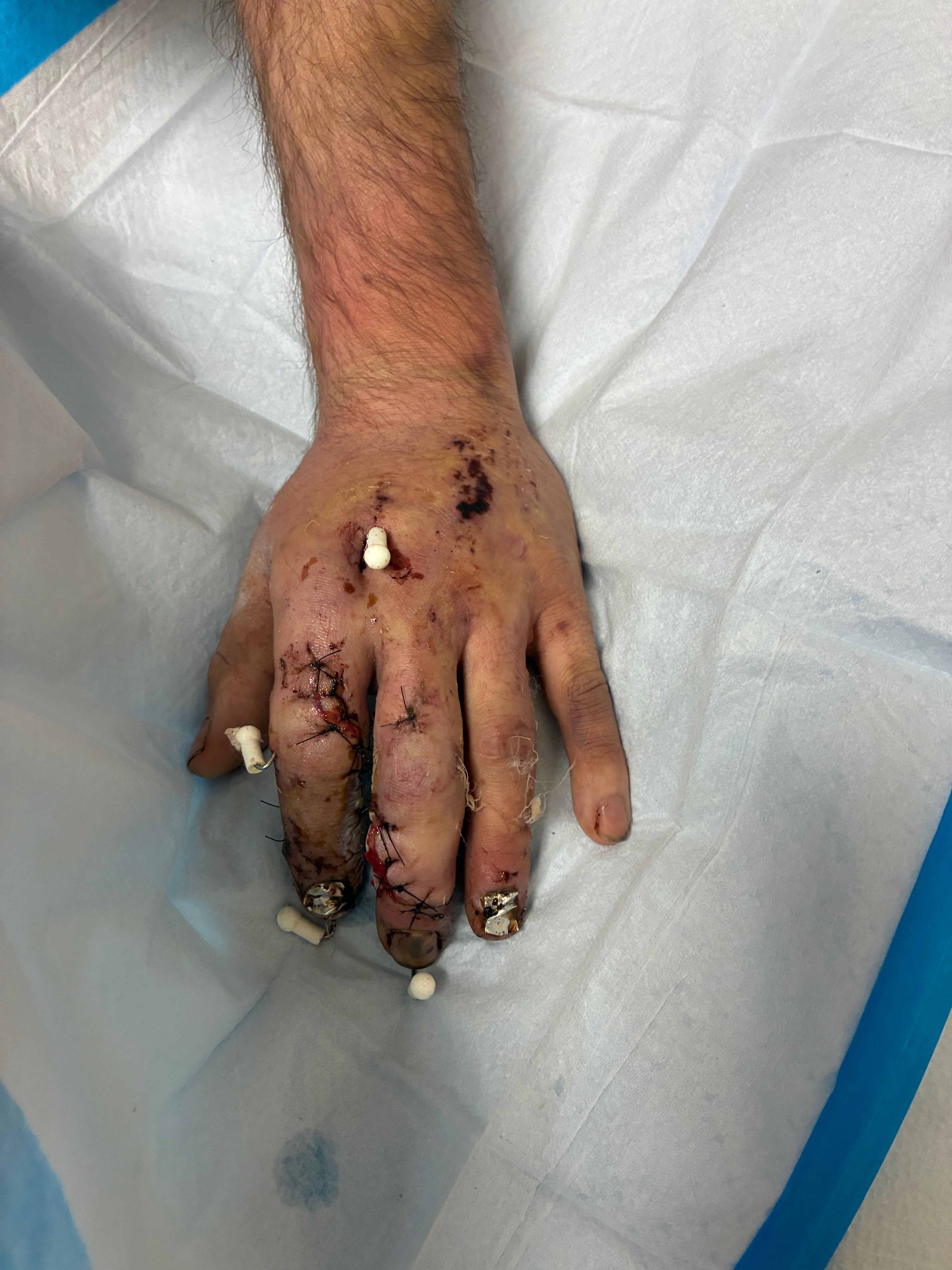 Support Michael's Recovery After Car Accident campaign photo, 5 of 6