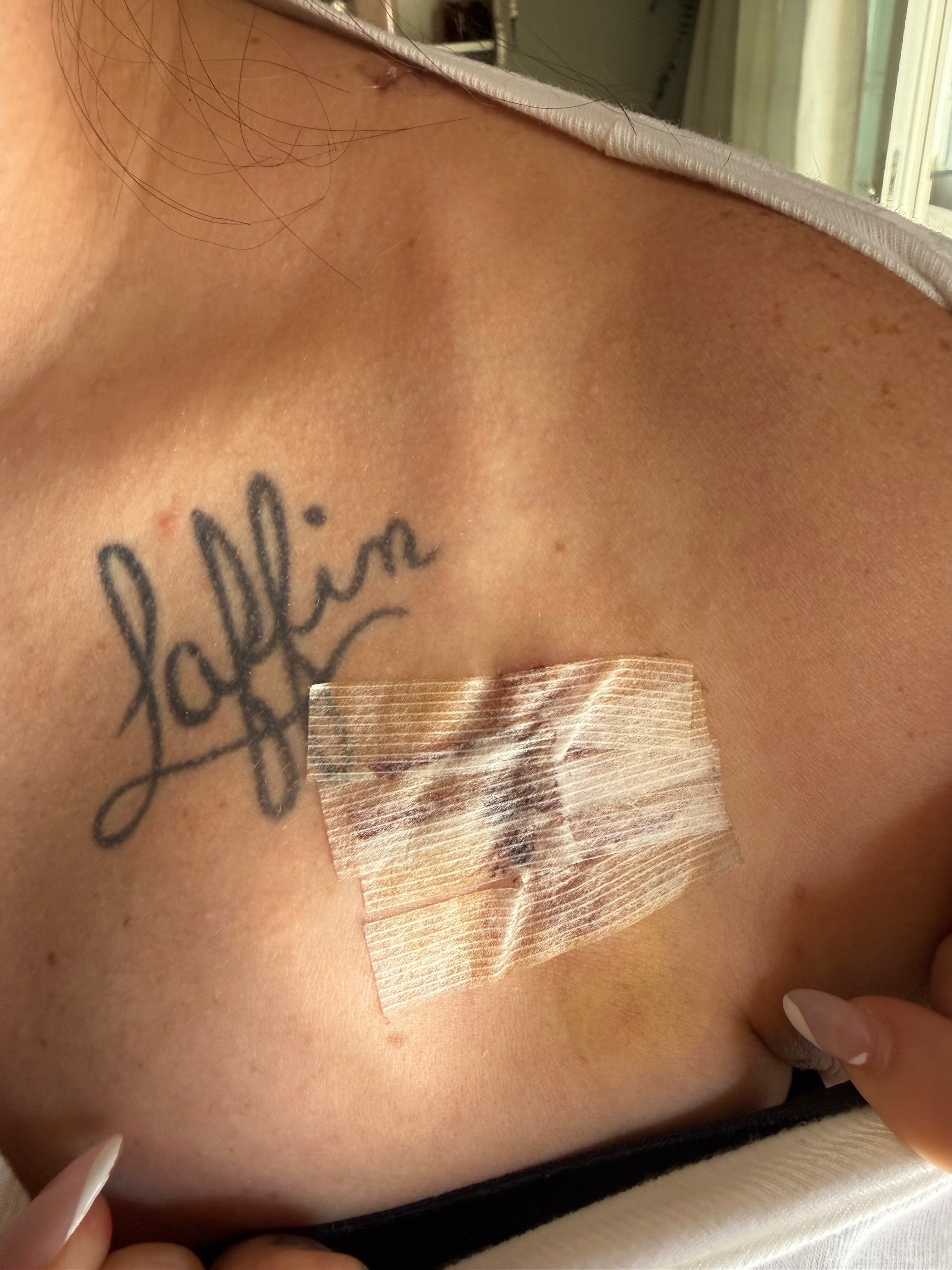 Support Ashley's Journey to Migraine Relief campaign photo, 2 of 8