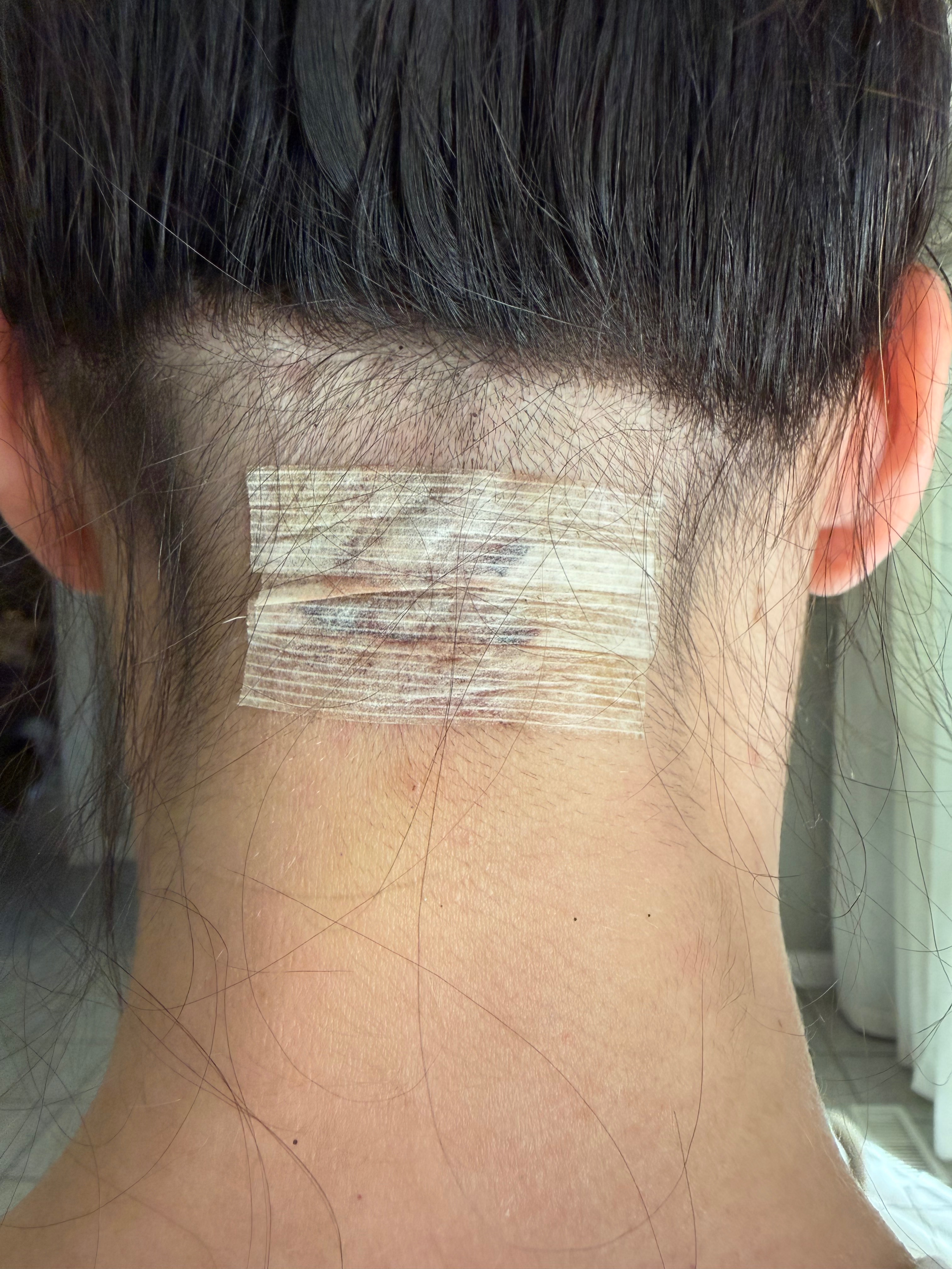 Support Ashley's Journey to Migraine Relief campaign photo, 4 of 8