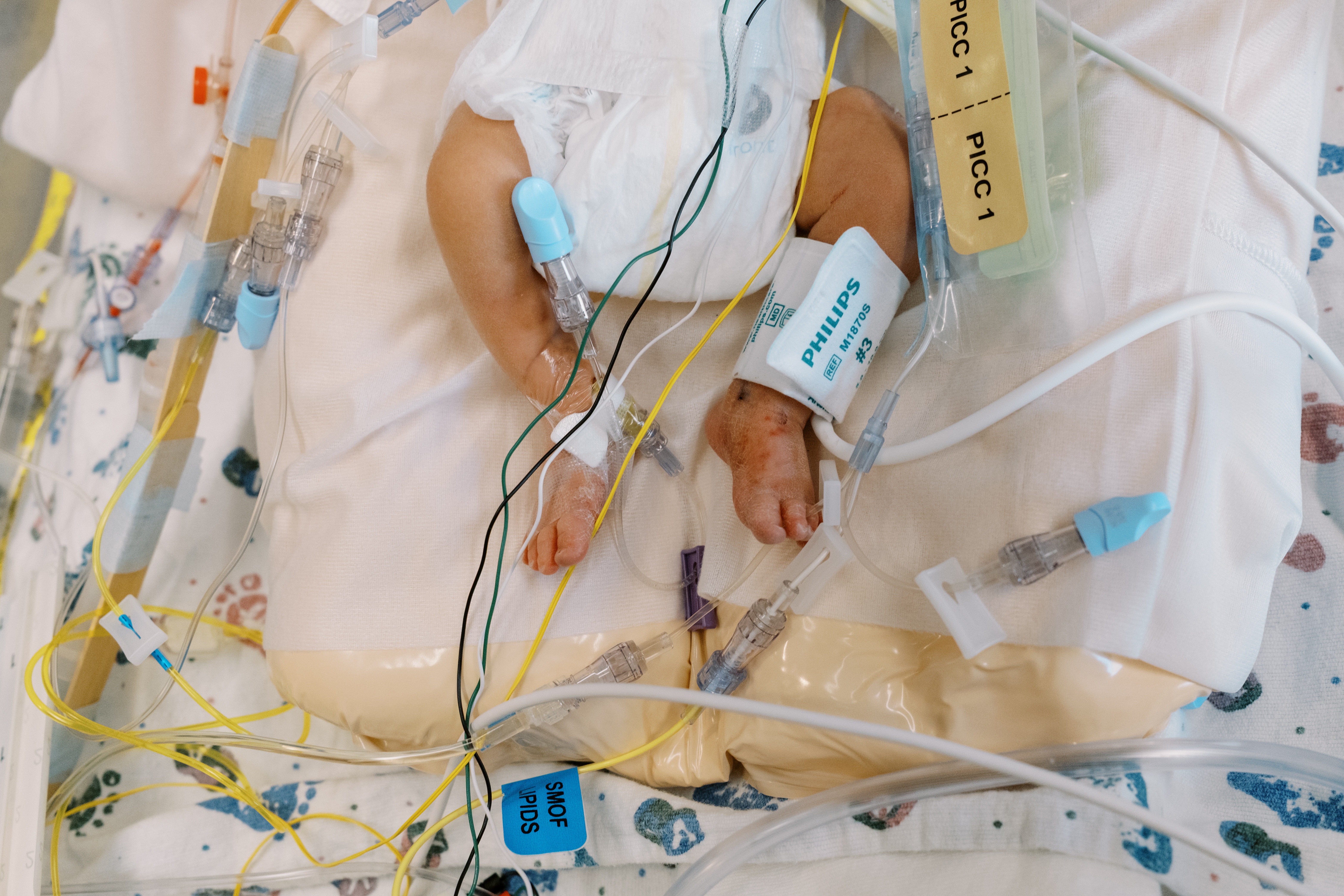 Support Baby Lydia's NICU Journey campaign photo, 4 of 6