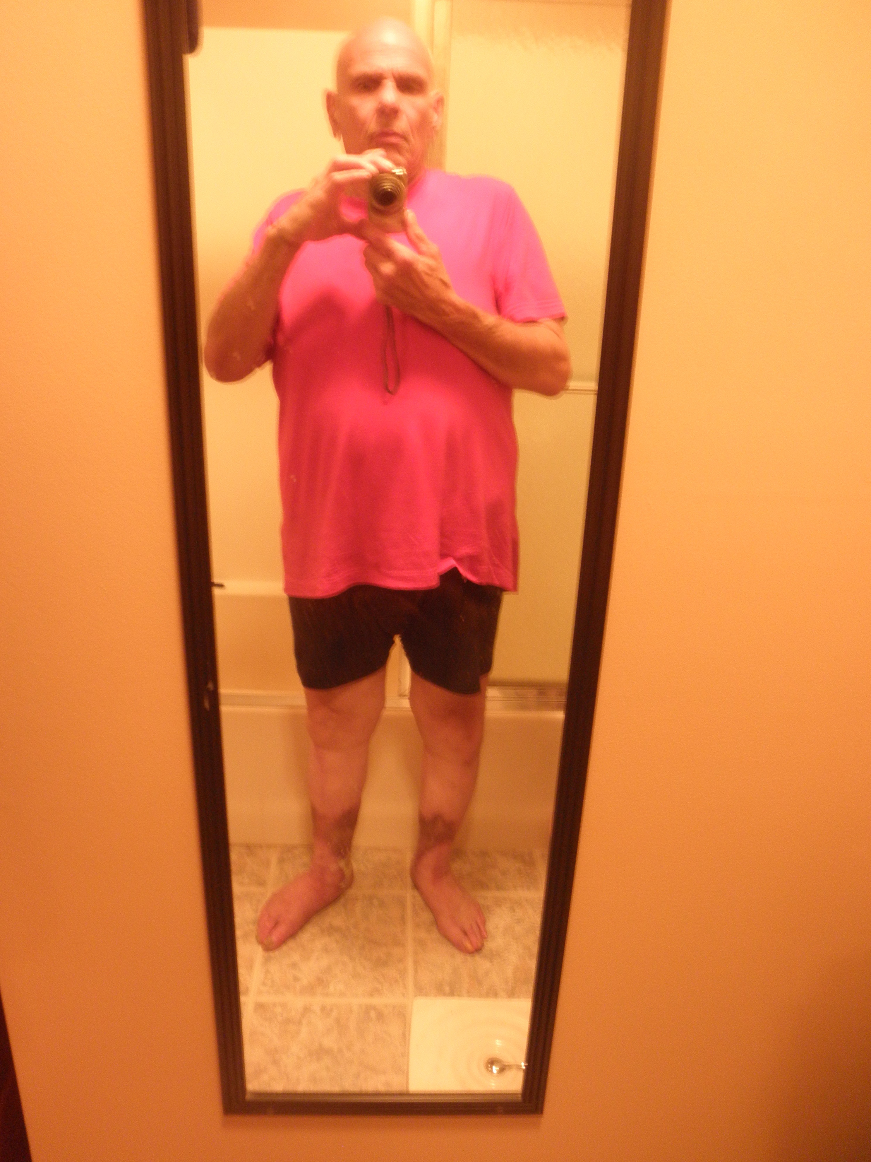 Support Joseph's Battle with Chronic Venous Insufficiency campaign photo, 6 of 7
