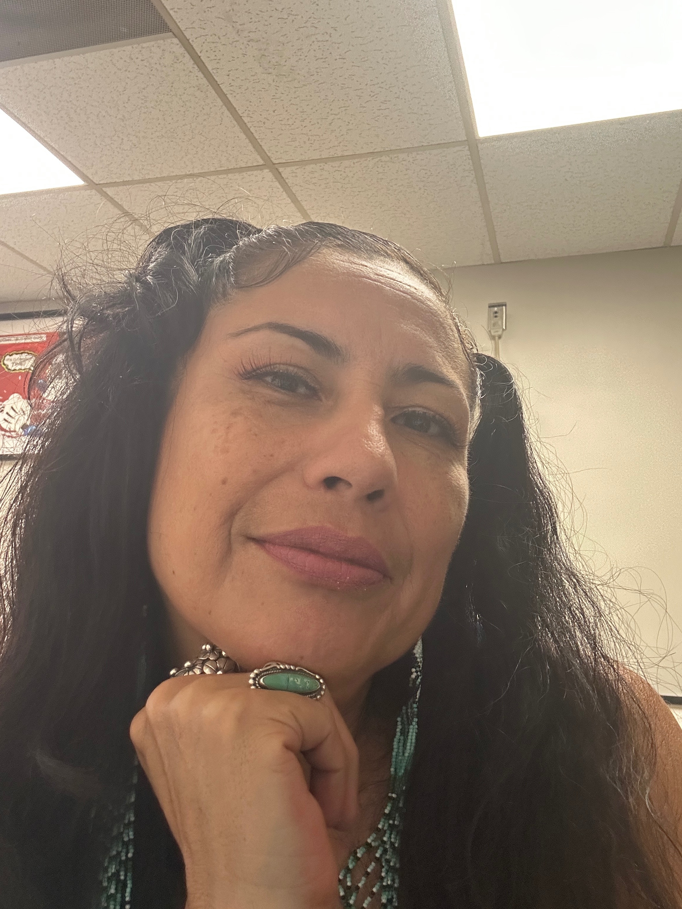 Urgent Surgery Support Needed for Artist Liliflor campaign photo, 5 of 6