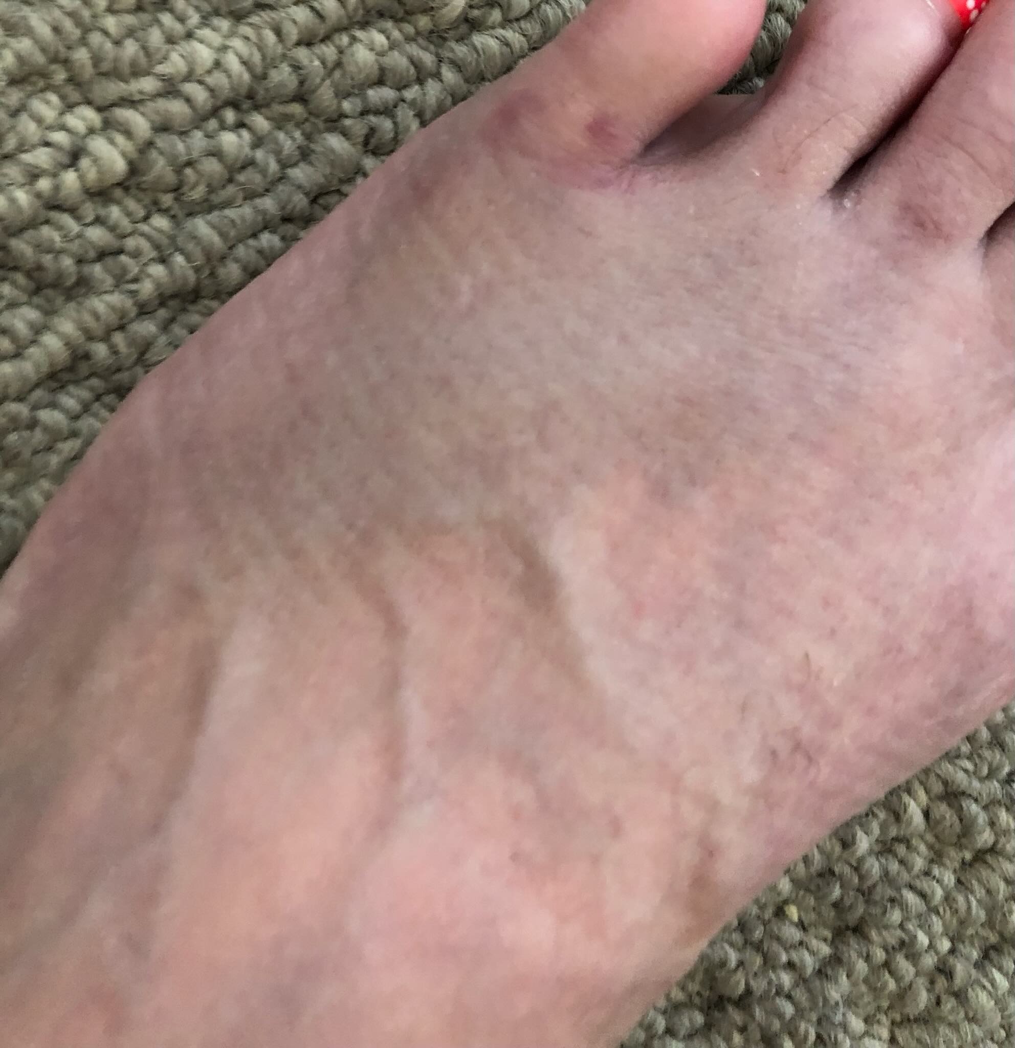 Help a mom fight CRPS and access life changing treatment campaign photo, 4 of 8