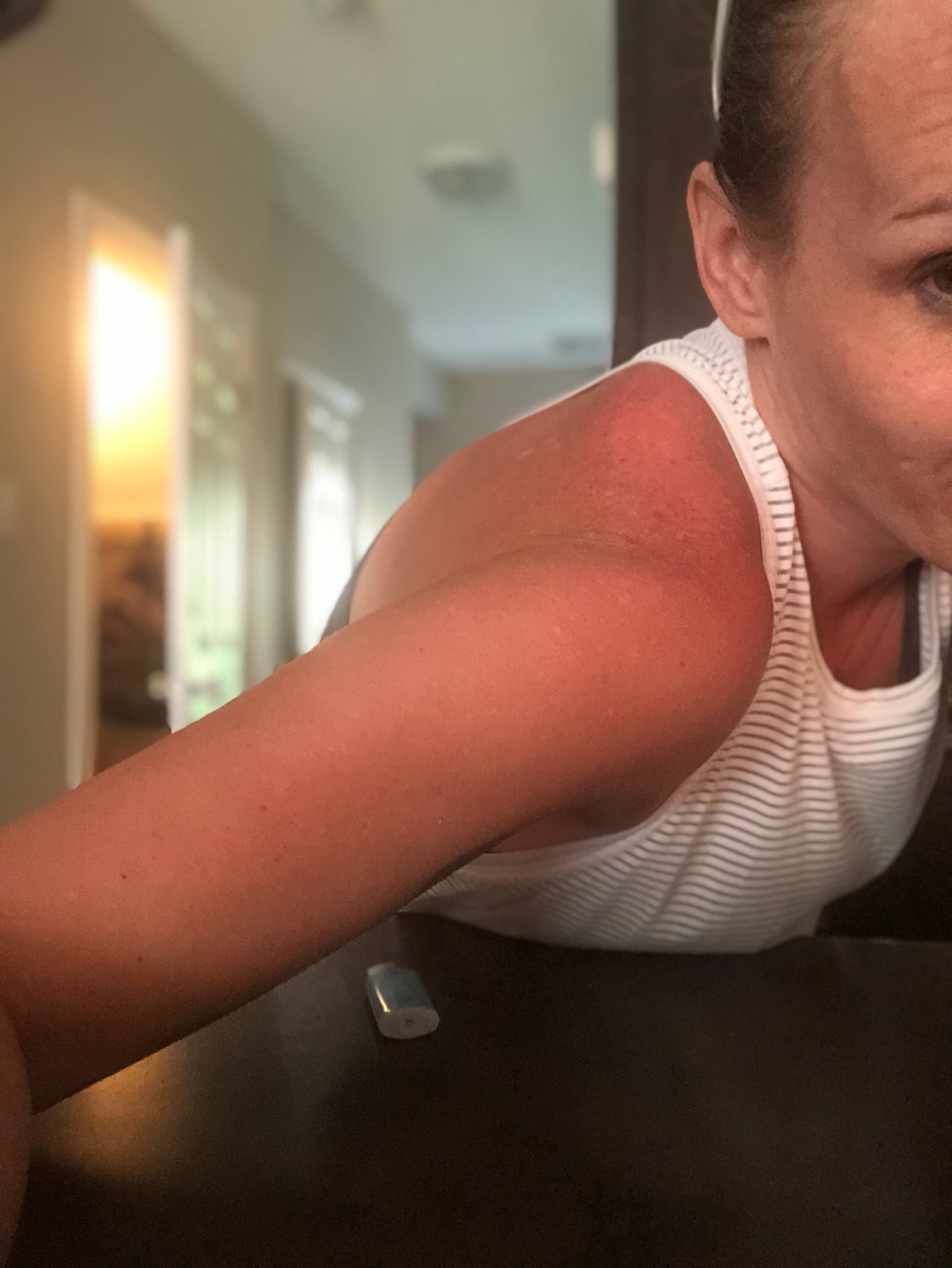Help a mom fight CRPS and access life changing treatment campaign photo, 5 of 8