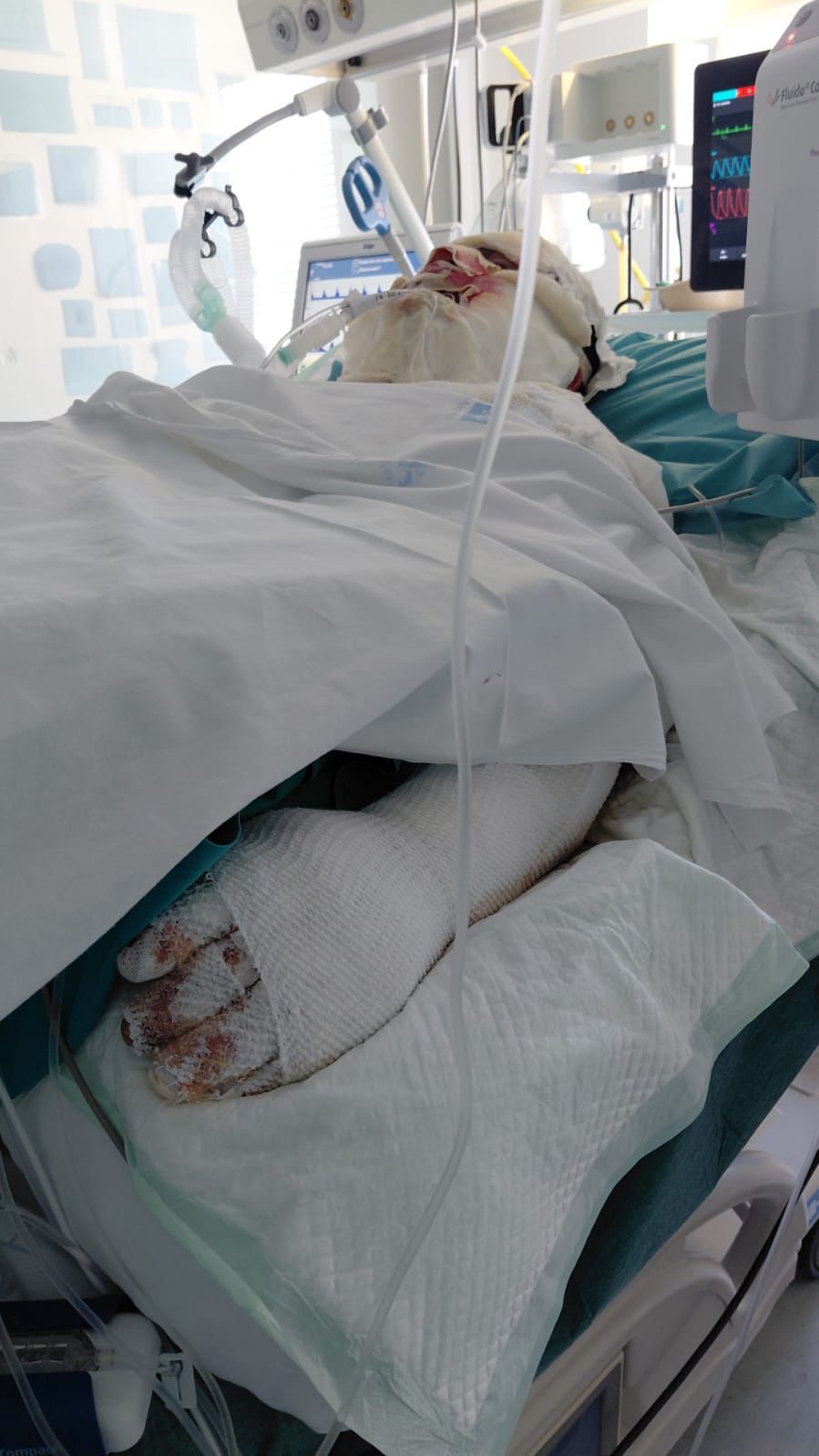Emergency Support for Burn Victim of Madrid Explosion campaign photo, 6 of 8