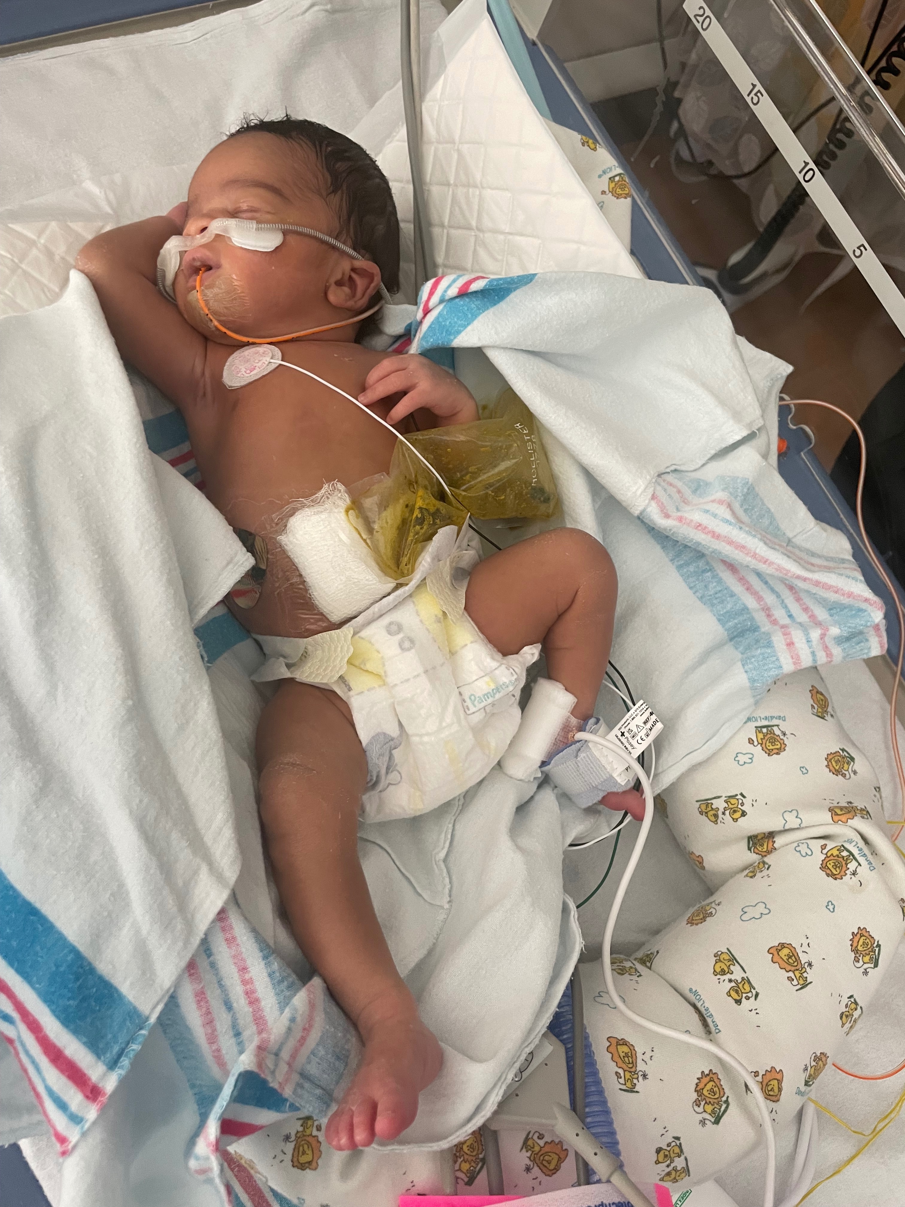 Help Cay’dence: Overcome Birth Defect Challenges campaign photo, 6 of 8