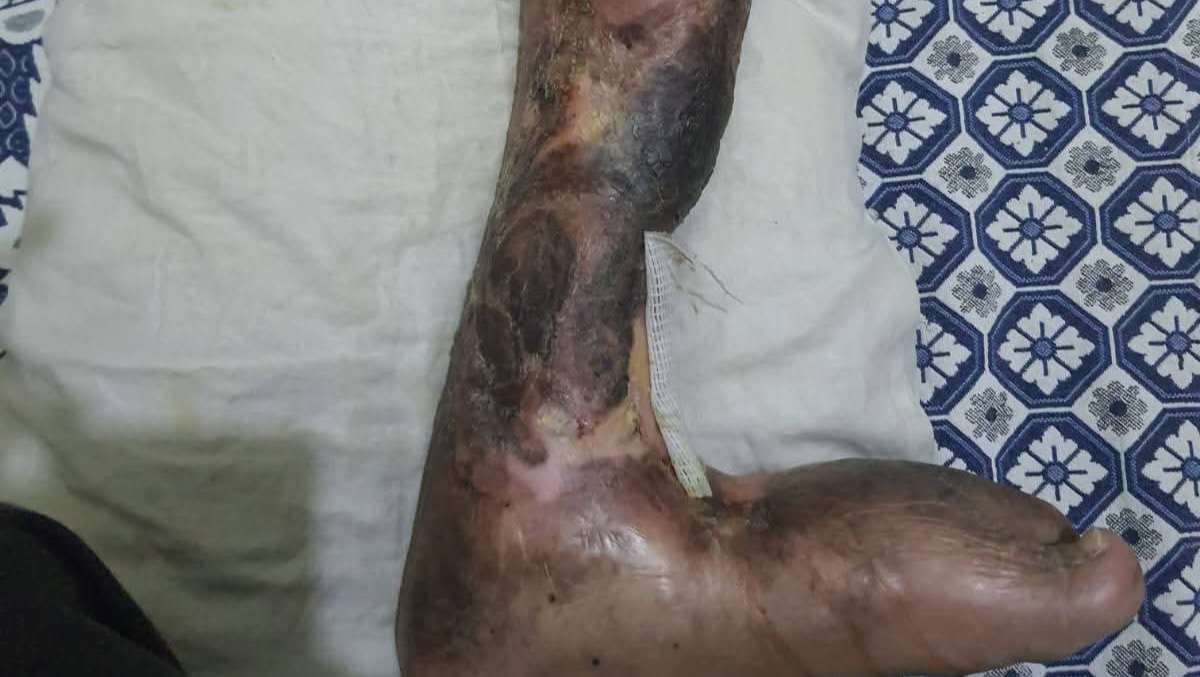 Urgent Medical Appeal: Alleviating Severe Suffering photo