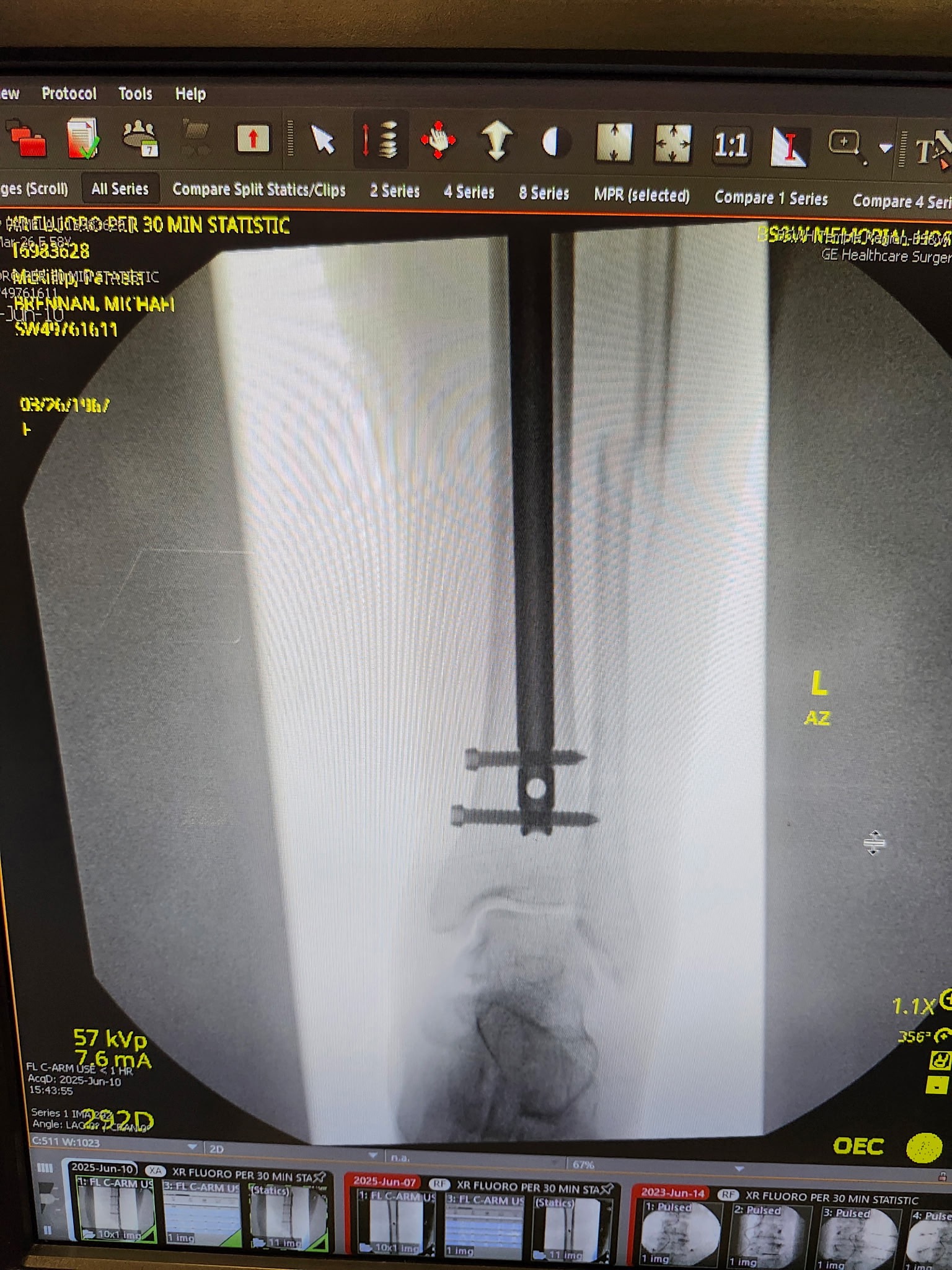DONATE TO HELP 58 YO FEMALE WITH MEDICAL BILLS campaign photo, 2 of 8