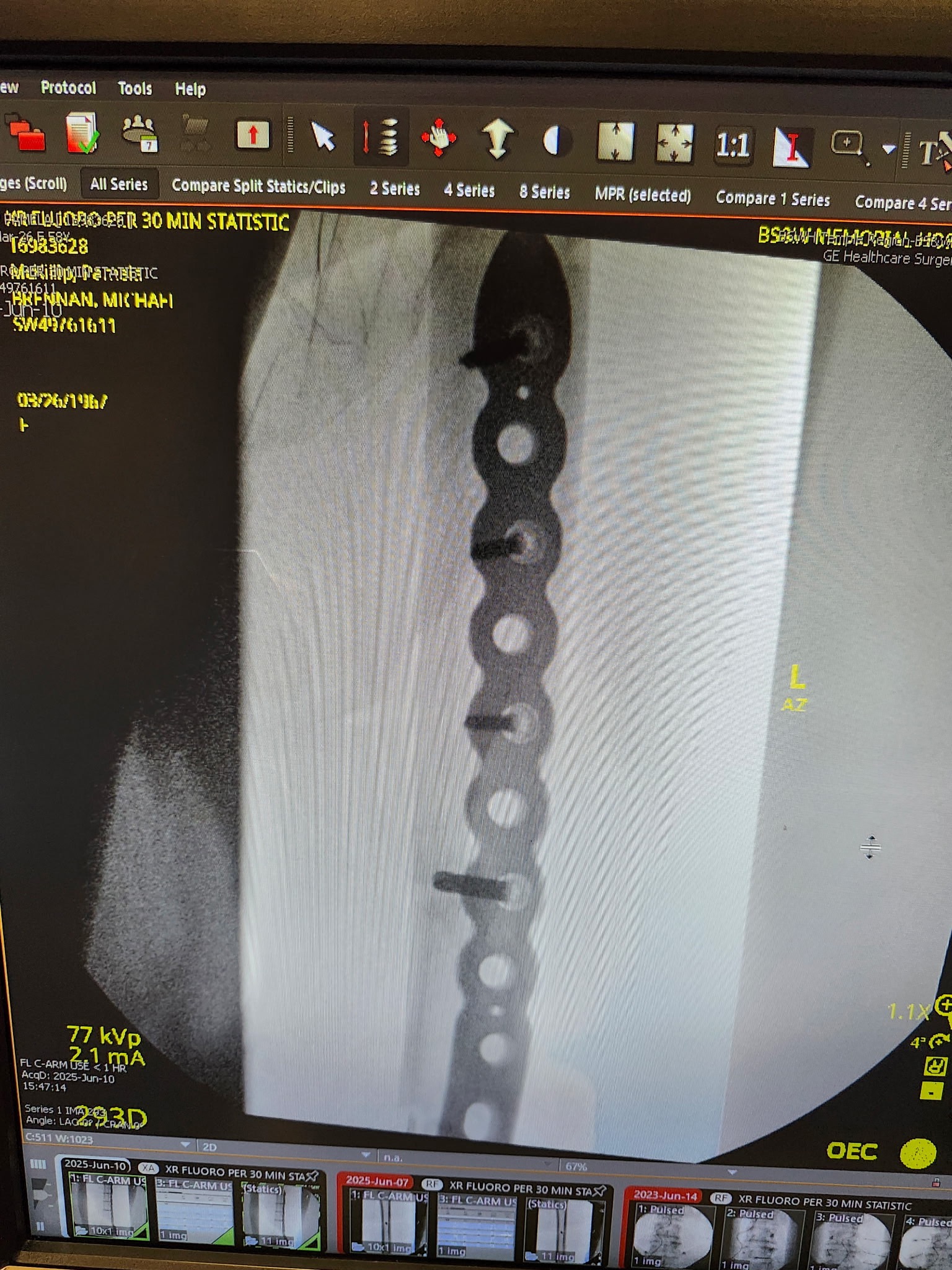 DONATE TO HELP 58 YO FEMALE WITH MEDICAL BILLS campaign photo, 7 of 8