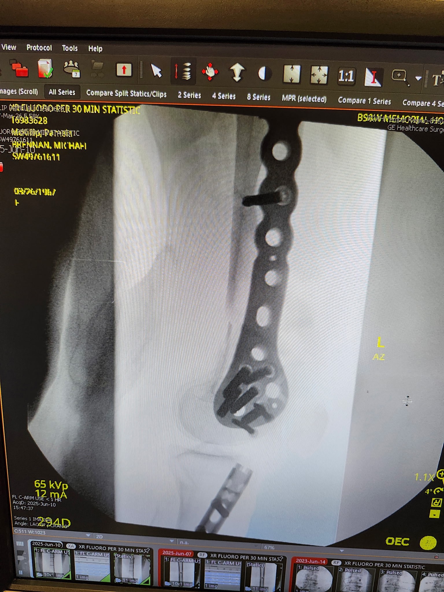 DONATE TO HELP 58 YO FEMALE WITH MEDICAL BILLS campaign photo, 6 of 8