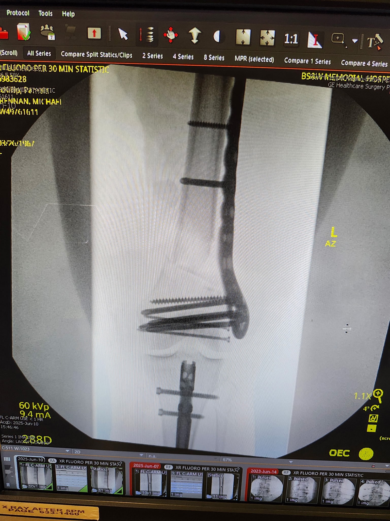 DONATE TO HELP 58 YO FEMALE WITH MEDICAL BILLS campaign photo, 5 of 8