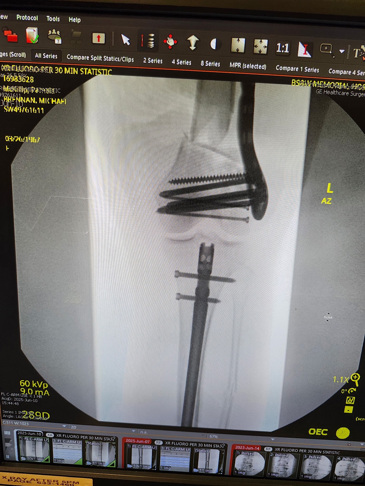 DONATE TO HELP 58 YO FEMALE WITH MEDICAL BILLS campaign photo, 4 of 8