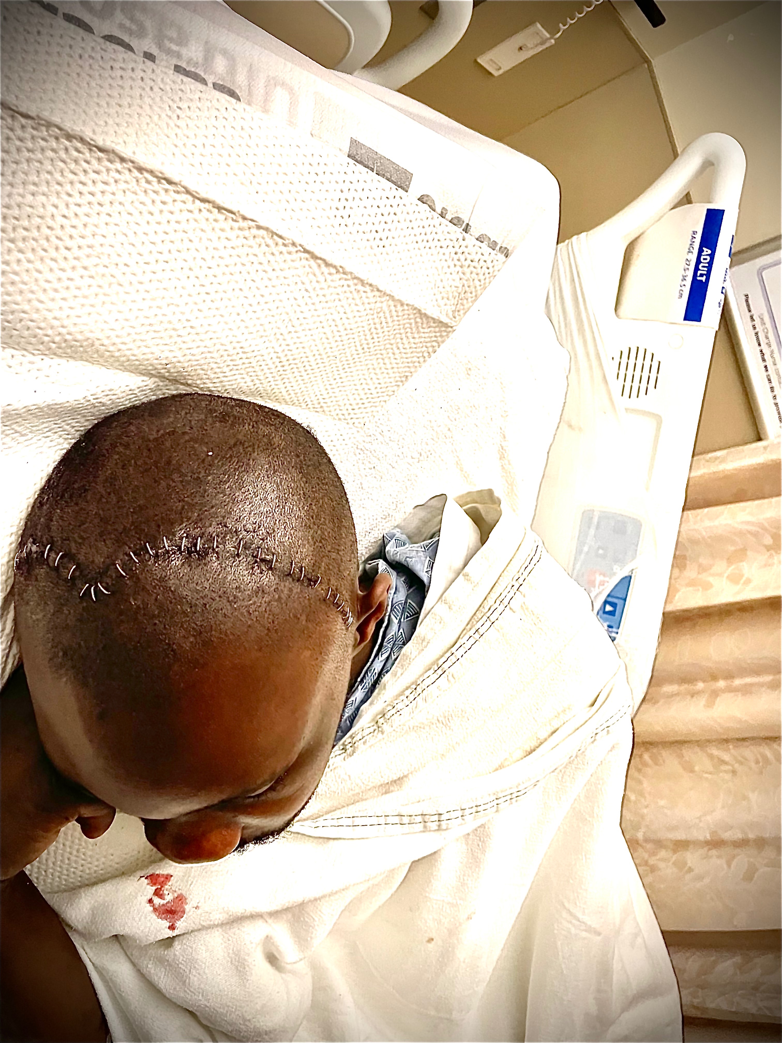 Help Support Jarvis’s Recovery After Hit-and-Run campaign photo, 4 of 8