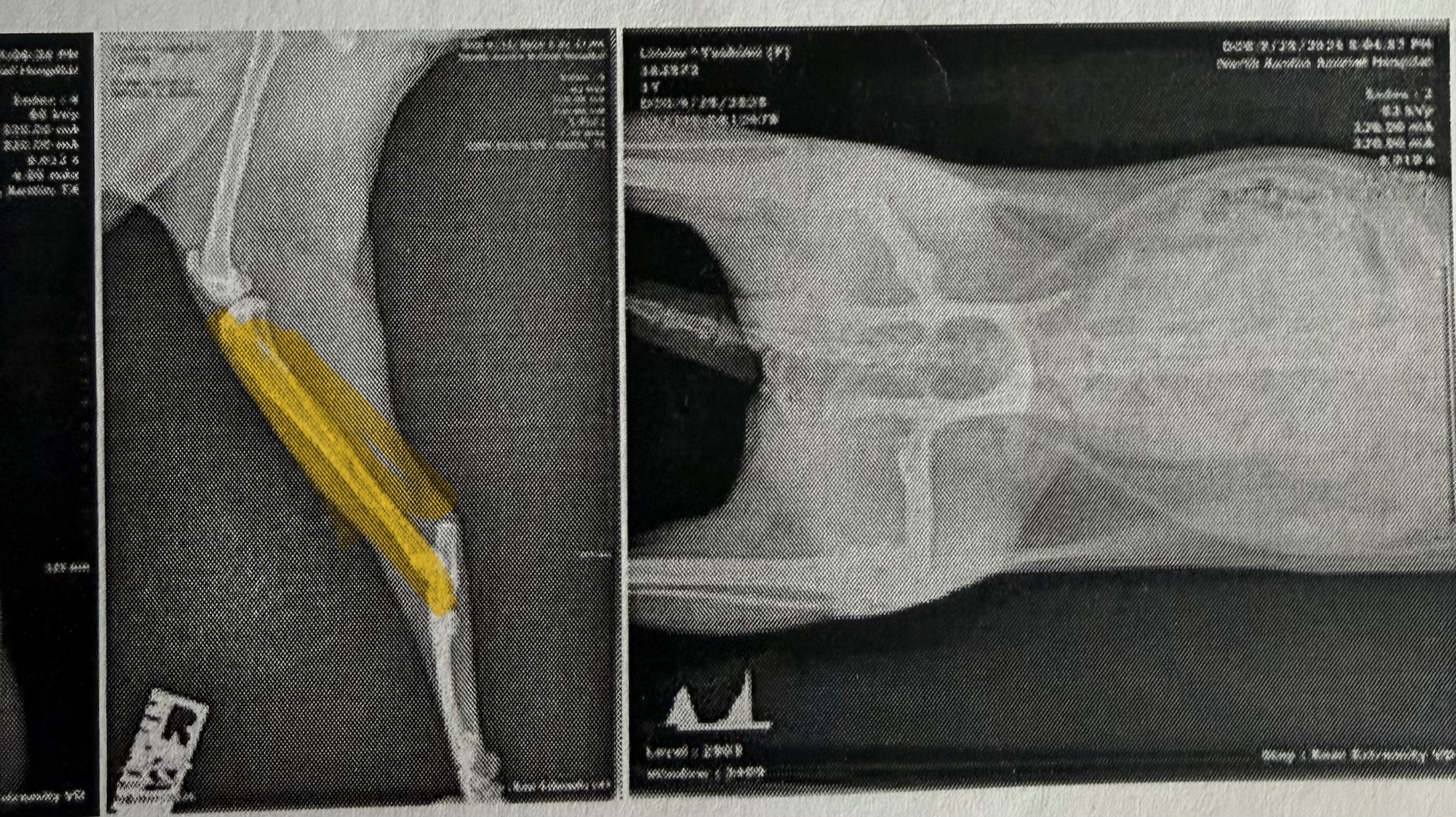 help Yoshimi get surgery so she can keep her leg! campaign photo, 2 of 7