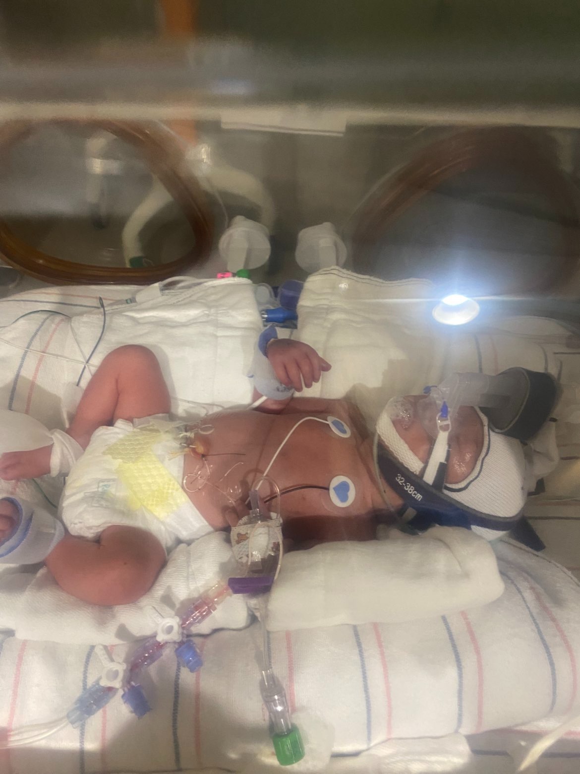 Help the Murray family with medical bills and every day expe campaign photo, 4 of 5
