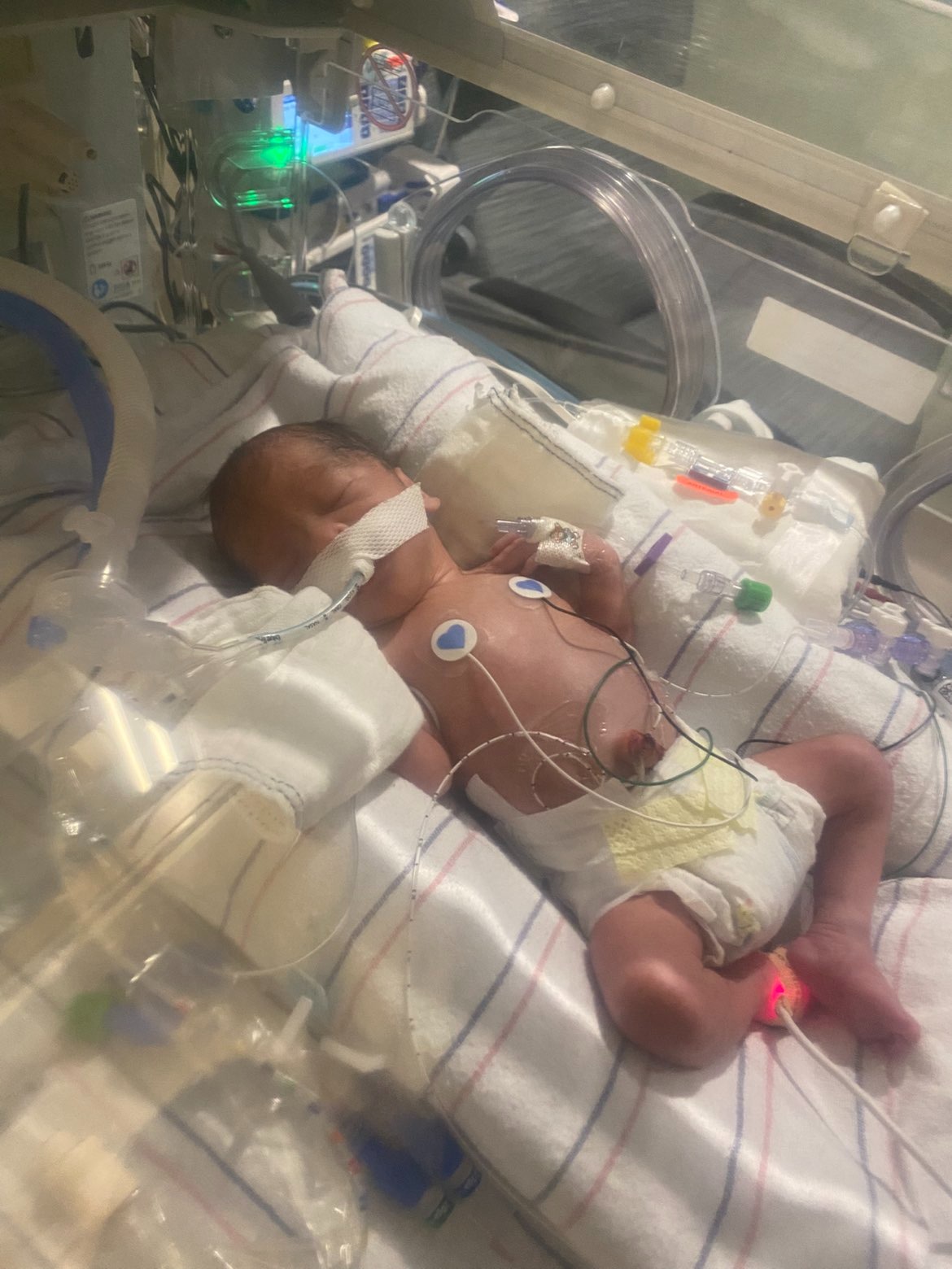 Help the Murray family with medical bills and every day expe campaign photo, 2 of 5