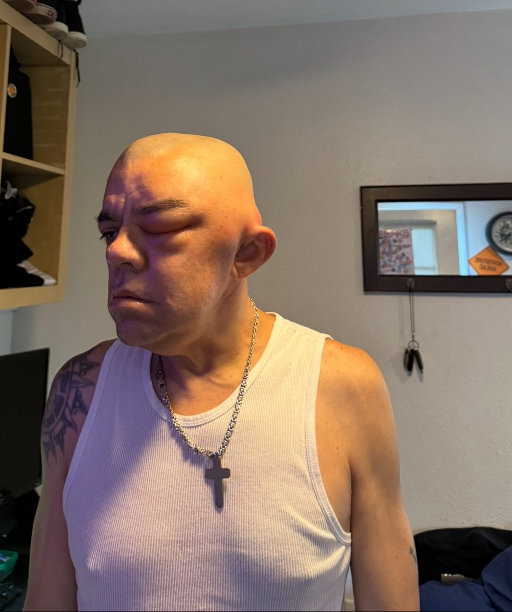 Support Alfonso with stage 4 brain cancer campaign photo, 6 of 7