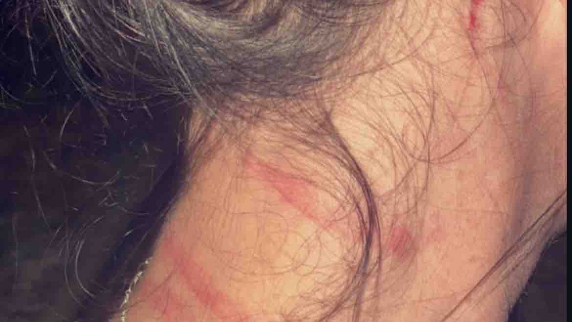 Help a domestic violence victim photo
