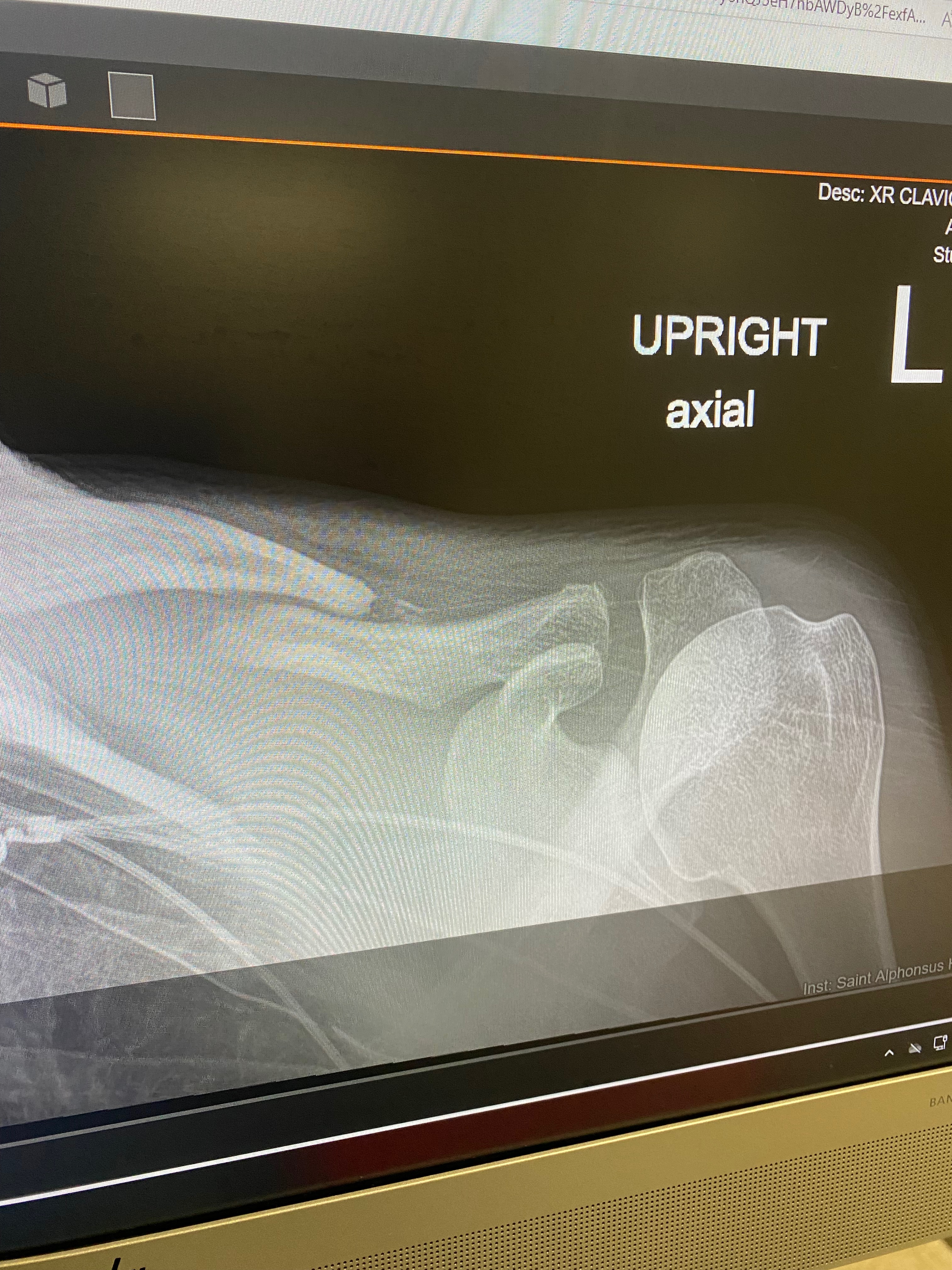 Bryce Bronson II Motorcycle Accident campaign photo, 4 of 7
