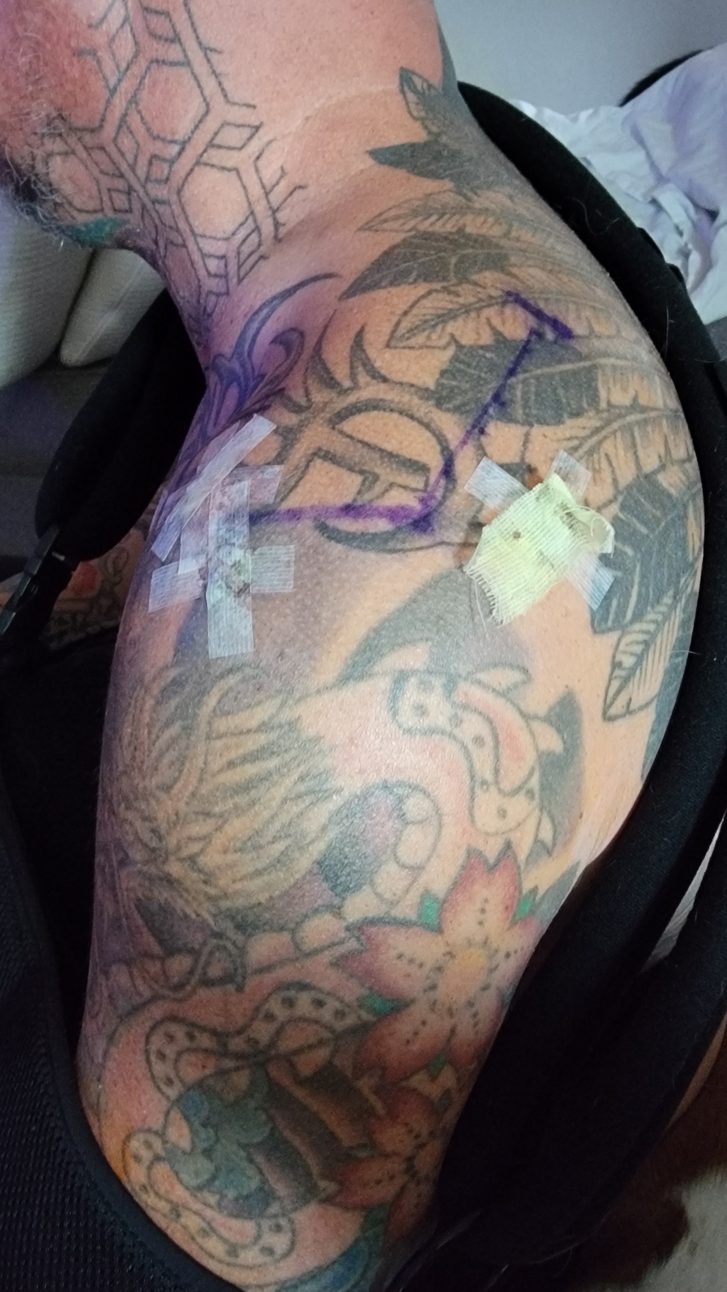 Support Sam's Second Shoulder Surgery campaign photo, 4 of 6