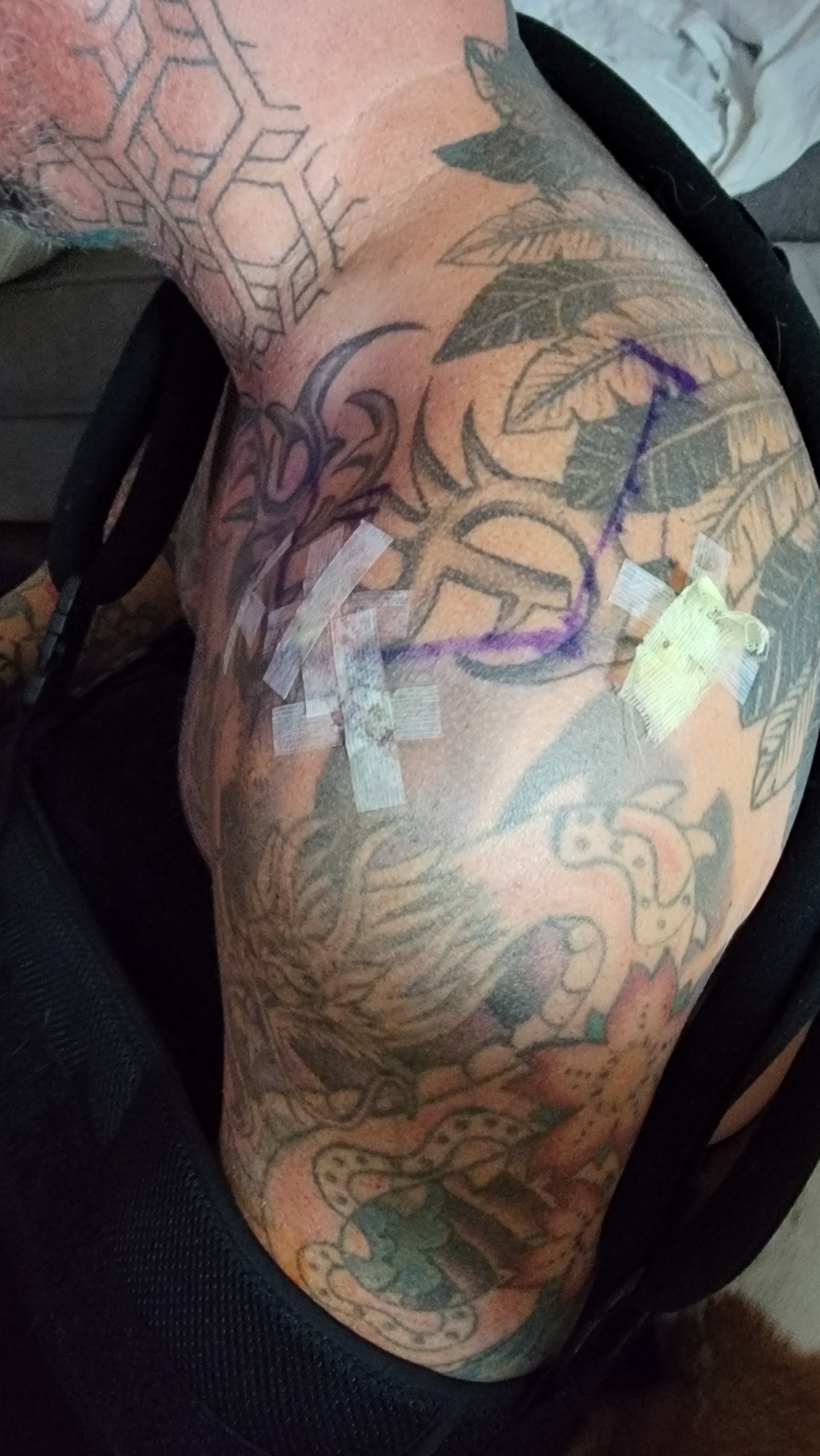 Support Sam's Second Shoulder Surgery campaign photo, 2 of 6