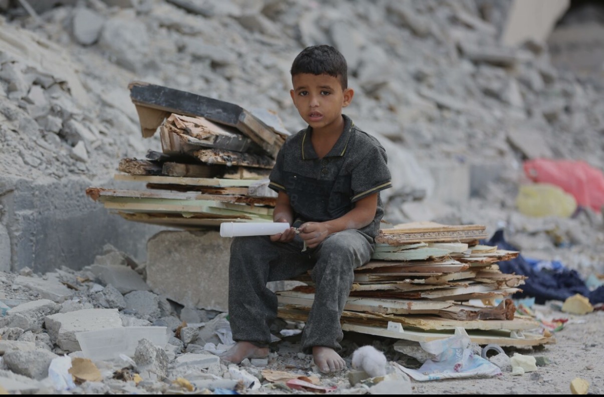 Feed Hope: Help Children in Yemen Survive campaign photo, 2 of 5